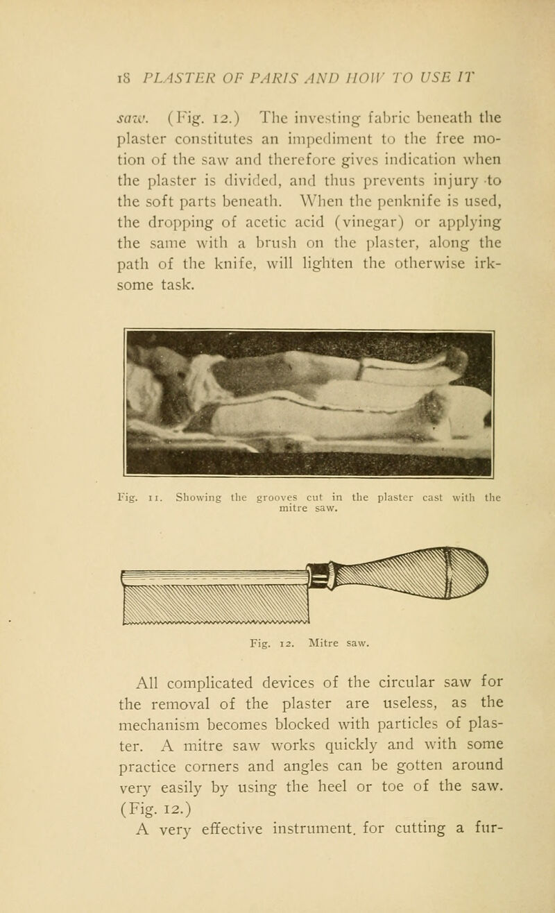 saic. (l''ig. 12.) The investing fabric l)eneath the plaster constitutes an impediment to the free mo- tion of the saw and therefore gives indication when the plaster is divided, and thus prevents injury to the soft parts beneath. When the penknife is used, the dropping of acetic acid (vinegar) or applying the same with a brush on the plaster, along the path of the knife, will lighten the otherwise irk- some task. ^^^ %-jn: 41 1 i Fig. II. Showing tiie grooves cut in the plaster cast with the mitre saw. Fig. 12. Mitre saw. All complicated devices of the circular saw for the removal of the plaster are useless, as the mechanism becomes blocked with particles of plas- ter. A mitre saw works quickly and with some practice corners and angles can be gotten around very easily by using the heel or toe of the saw. (Fig. 12.) A very effective instrument, for cutting a fur-