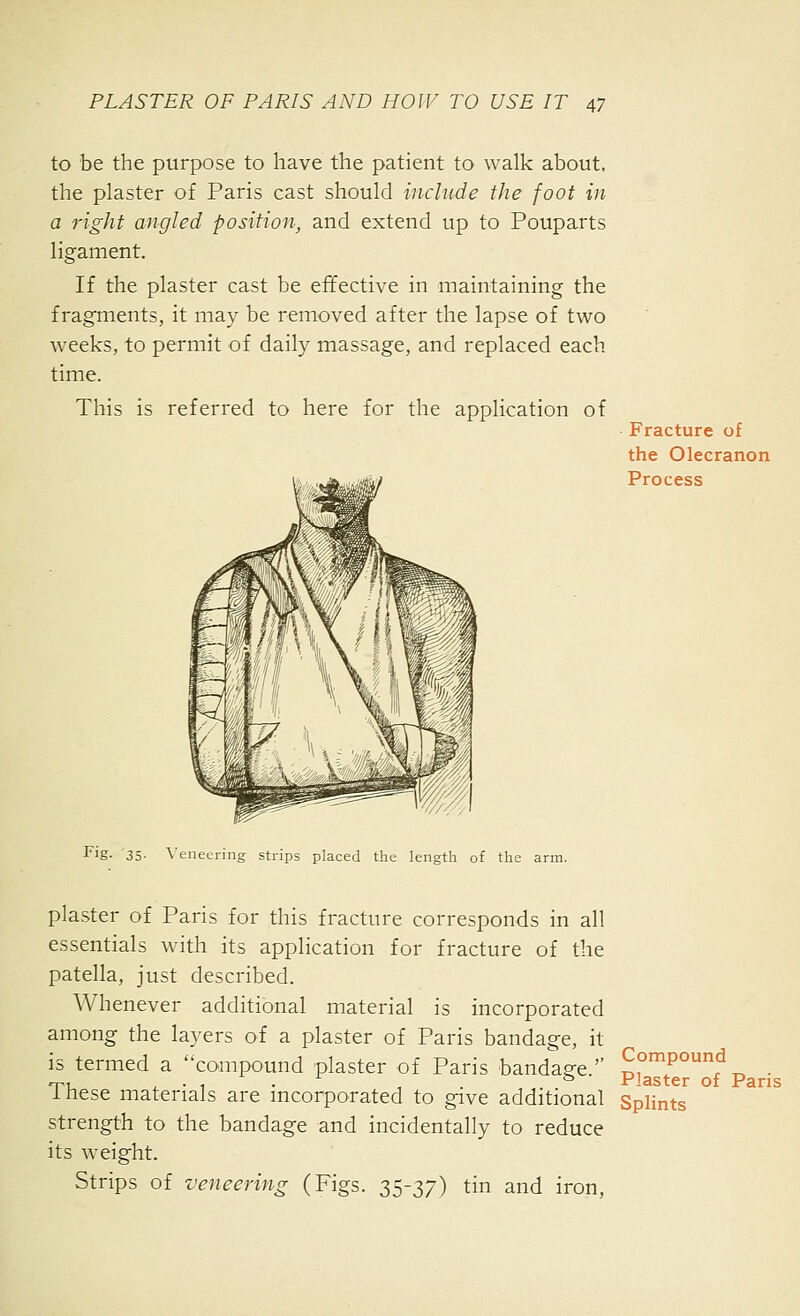 to be the purpose to have the patient to walk about, the plaster of Paris cast should include the foot in a right angled position, and extend up to Pouparts ligament. If the plaster cast be effective in maintaining the fragments, it may be removed after the lapse of two weeks, to permit of daily massage, and replaced each time. This is referred to here for the application of Fracture of the Olecranon Process Fig- 35- \'eneering strips placed the length of the arm. plaster of Paris for this fracture corresponds in all essentials with its application for fracture of the patella, just described. Whenever additional material is incorporated among the layers of a plaster of Paris bandage, it is termed a compound plaster of Paris bandage. di°T°^^t3 • •-pi . • -i • , . iriaster 01 Paris Ihese materials are mcorporated to give additional Splints strength to the bandage and incidentally to reduce its weight. Strips of veneering (Figs. 35-37) tin and iron,