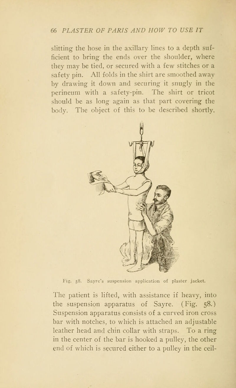 slitting the hose in the axillary lines to a depth suf- ficient to bring the ends over the shoulder, where they may be tied, or secured with a few stitches or a safety pin. All folds in the shirt are smoothed away by drawing it down and securing it snugly in the perineum with a safety-pin. The shirt or tricot should be as long again as that part covering the body. The object of this to be described shortly. Fig. 58. Sayre's suspension application of plaster jacket. The patient is lifted, with assistance if heavy, into the suspension apparatus of Say re. (Fig. 58.) Suspension apparatus consists of a curved iron cross bar with notches, to which is attached an adjustable leather head and chin collar with straps. To a ring in the center of the bar is hooked a pulley, the other end of which is secured either to a pulley in the ceil-