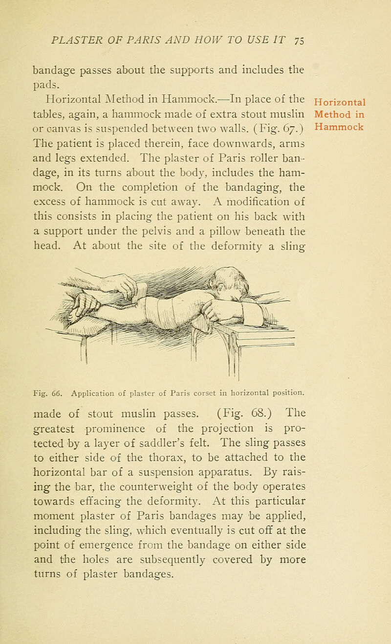 bandage passes about the supports and includes the pads. Horizontal Alethod in Hammock.—In place of the tables, again, a hammock made of extra stout muslin or canvas is suspended between two w^alls. (Fig. 67.) The patient is placed therein, face downwards, arms and legs extended. The plaster of Paris roller ban- dage, in its turns about the body, includes the ham- mock. On the completion of the bandaging, the excess of hammock is cut away. A modification of this consists in placing the patient on his back with a support under the pelvis and a pillow beneath the head. At about the site of the deformity a sling Horizontal Method in Hammock Fig. 66. Application of plaster of Paris corset in horizontal position. made of stout muslin passes. (Fig. 68.) The greatest prominence of the projection is pro- tected by a layer of saddler's felt. The sling passes to either side of the thorax, to be attached to the horizontal bar of a suspension apparatus. By rais- ing the bar, the counterweight of the body operates towards effacing the deformity. At this particular moment plaster of Paris bandages may be applied, including the sling, which eventually is cut off at the point of emergence from the bandage on either side and the holes are subsequently covered by more turns of plaster bandages.