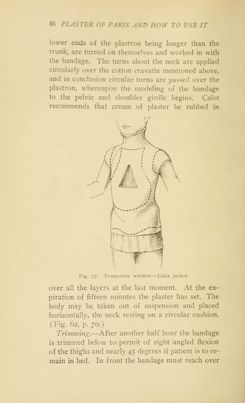 lower ends of the plastron being longer than the trunk, are turned on themselves and worked in with the bandage. The turns about the neck are applied circularly over the cotton cravatte mentioned above, and in conclusion circular turns are passed over the plastron, whereupon the modeling of the bandage to the pelvic and shoulder girdle begins. Calot recommends that cream of plaster be rubbed in rig. 77. Temporary window—Calot jacket. over all the layers at the last moment. At the ex- piration of fifteen minutes the plaster has set. The body may be taken out of suspension and placed horizontally, the neck resting on a circular cushion, (Fig. 62, p. 70.) Tri)nining.—After another half hour the bandage is trimmed below to permit of right angled flexion of the thighs and nearly 45 degrees if patient is to re- main in bed. In front the bandage must reach over