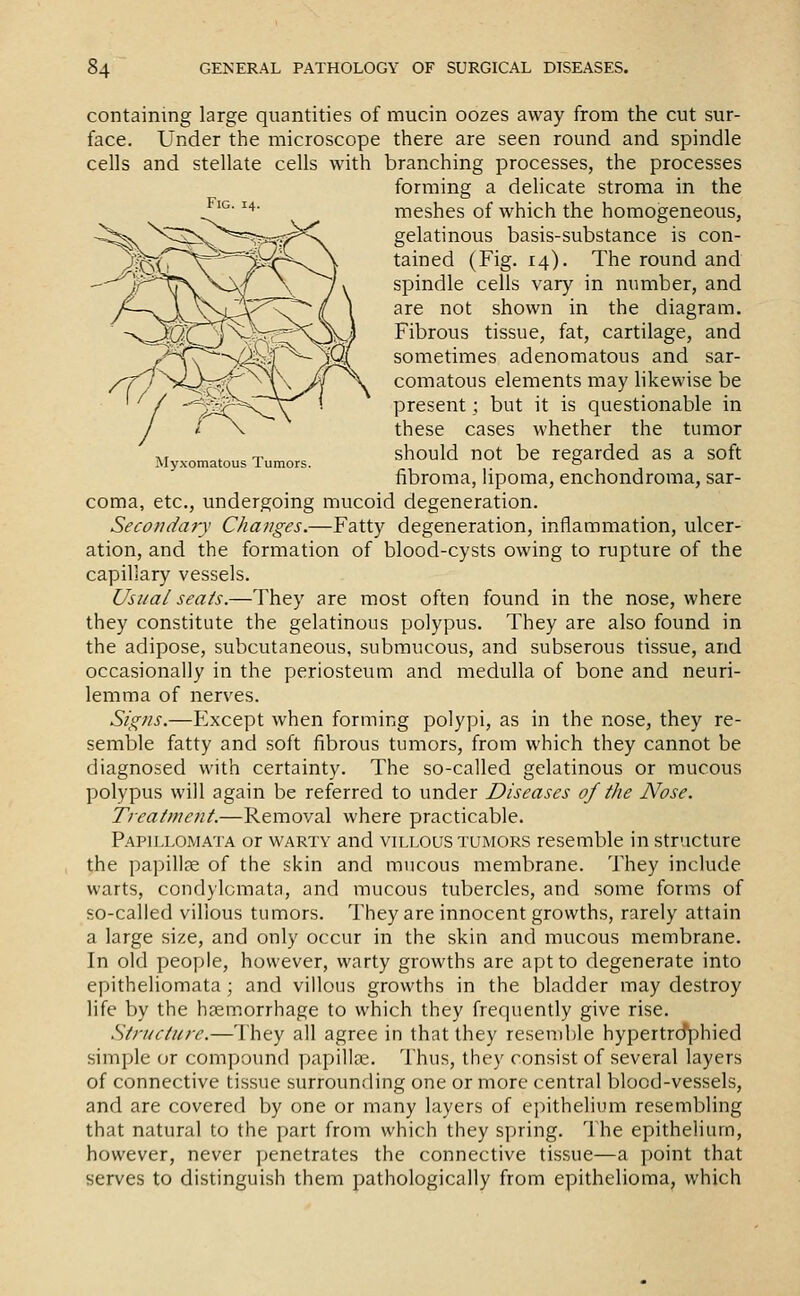Fig. 14. INIyxomatous Tumors. containing large quantities of mucin oozes away from the cut sur- face. Under the microscope there are seen round and spindle cells and stellate cells with branching processes, the processes forming a delicate stroma in the meshes of which the homogeneous, gelatinous basis-substance is con- tained (Fig. 14). The round and spindle cells vary in number, and are not shown in the diagram. Fibrous tissue, fat, cartilage, and sometimes adenomatous and sar- comatous elements may likewise be present; but it is questionable in these cases whether the tumor should not be regarded as a soft fibroma, lipoma, enchondroma, sar- coma, etc., undergoing mucoid degeneration. Secondary Changes.—Fatty degeneration, inflammation, ulcer- ation, and the formation of blood-cysts owing to rupture of the capillary vessels. Usual seats.—They are most often found in the nose, where they constitute the gelatinous polypus. They are also found in the adipose, subcutaneous, submucous, and subserous tis.sue, and occasionally in the periosteum and medulla of bone and neuri- lemma of nerves. Signs.—Except when forming polypi, as in the nose, they re- semble fatty and soft fibrous tumors, from which they cannot be diagnosed with certainty. The so-called gelatinous or mucous polypus will again be referred to under Diseases of the Nose. Tieatment.—Removal where practicable. Papillomata or warty and villous tumors resemble in structure the papillae of the skin and raucous membrane. They include warts, condylomata, and mucous tubercles, and some forms of so-called villous tumors. They are innocent growths, rarely attain a large size, and only occur in the skin and mucous membrane. In old people, however, warty growths are apt to degenerate into epitheliomata; and villous growths in the bladder may destroy life by the haemorrhage to which they frequently give rise. Structure.—They all agree in that they resemble hypertrcfphied simple or compound papilla.'. Thus, they consist of several layers of connective tissue surrounding one or more central blood-vessels, and are covered by one or many layers of epithelium resembling that natural to the part from which they spring. The epithelium, however, never penetrates the connective tissue—a point that serves to distinguish them pathologically from epithelioma, which