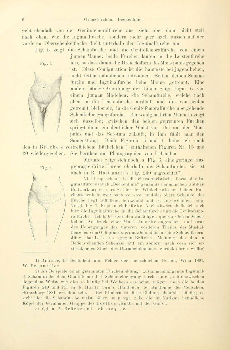 riiTii'/.rurclicii. TicckOlli nie.. / gellt c])Ciifiills von fler (ioiiitotV'nioi-airiirchc. ;uis, /.iclit mIkt (l;niii iiiclil steil nach oben, wie die inii'uinalinrclic, sdiidern mehr ([urv nach aussen auf der vorderen ()l)ersehenUelfl;teiie dicht nntei'halh der in,i;-iiinail'iirelic iiin. l'^ii;-. f) /.eij;t die Schanii'nrclie inid die Genitofenioralf'urchc von einem j'nngen Manne; hcidc l''nrciien lani'en in die Leistentiirche Fig. 5. aus, so dass damit die Dreieeksforni des Mons j)iil)is gegeben ist. Diese Confignration ist die hantigste bei jugendlichen, nicht fetten männlichen Individuen. Selten bleiben Schani- furche und Inguinalturche beim Wanne getrennt. Eine andere häufige Anordming der Linien zeigt ]<'ignr (i von einem jungen Mädchen: die Sehanifiireiu', weiche nach oben in die Leistenfurche ausläuft und die von beiden getrennt bleibende, in die Geuitofeuioralfurche übergehende Schenkelbeugungsfurche. Bei wohlgenährten Männern zeigt sieh dasselbe; zwischen den beiden getrennten Furchen springt dann ein deutlicher Wulst vor, der auf den Mons pubis und das Scrotum zuläuft; in ihm fühlt man den Samenstraug. Beide Figuren, 5 und t^, habe ich nach den in ]5rücke's vortrefflichem Büclielchen ■) enthaltenen Figuren Nr. 15 und 20 wiedergegeben. Sie beruhen auf Piiotographien von Lebenden. Mitunter zeigt sich noch, s. Fig. 6, eine geringer aus- Pi„.. (;, geprägte dritte Furche ol)erhalb der Sehamfurche, sie ist auch in R. Hart mann's Fig. 240 angedeutet-). Viel besproclienä) ist die cliaraktevistische Form der In- g'uinalfurche (auch „BecUenlinie g'enaiuit) bei inaneheii antiken Bildwerken; es springt liier der Winkel zwischen beiden Fnr- chenschenkehi weit nach vorn vor und der obere Schenkef der Furche liegt auffallend horizontal tind ist ungewöhnlich lang. Vergl. Fig. 7. Kopie nach Brücke. Nach abwärts theilt sich auch \ / hier die.Ingninalfurche in die Sehamfurche und die Genitofemo- ralfurche. Ich halie stets den auffälligen (|ueren oberen Schen- Ivel als Ausdruck einer Musl<elmarke angesehen, und zwar des Ueberg'ang'es des unteren vorderen Theiles des Muskel- fleische.s vom Obliquus externus abdominis in seine Sehnenfasern. Jüngst hat Lebouc(| (gegen Brücke's Meinung, der den in Rede stehenden Sclienkel auf ein abnorm nach vorn sich er- streckendes Stück des Darmbeinkammes zurückführen wollte) \ 1) Brücke, E., Schönheit und Fehler der inenschlichen Gestalt, Wien 1891. W. Braumüller. 2) Als Beispiele einer getreTuiten Furclienl)ilduiig: zusaiiimenhiingende Inguinal- + Schamfurche oben, Genitofemoral- + Sclienkelbeuginigsfurche unten, mit dazwischen liegendem Wulst, wie dies so liäufig bei Weibern erscheint, mögen noch die beiden Figuren 240 und 241 in Y\. Hart mann's Handbuch der Anatomie des Menschen, Strassburg 1881, erwähnt sein. — Bei Ivindern ist diese Bildung ebenfalls häufig; es steht hier die Schamfurche meist höher; man vgl. z. B. die im Vatikan lielindliche Kopie der berühmten Gruppe des Boethos „Knabe mit der Gans. 3) Vgl. u. A. Brücl^e und Leboucq 1. c.
