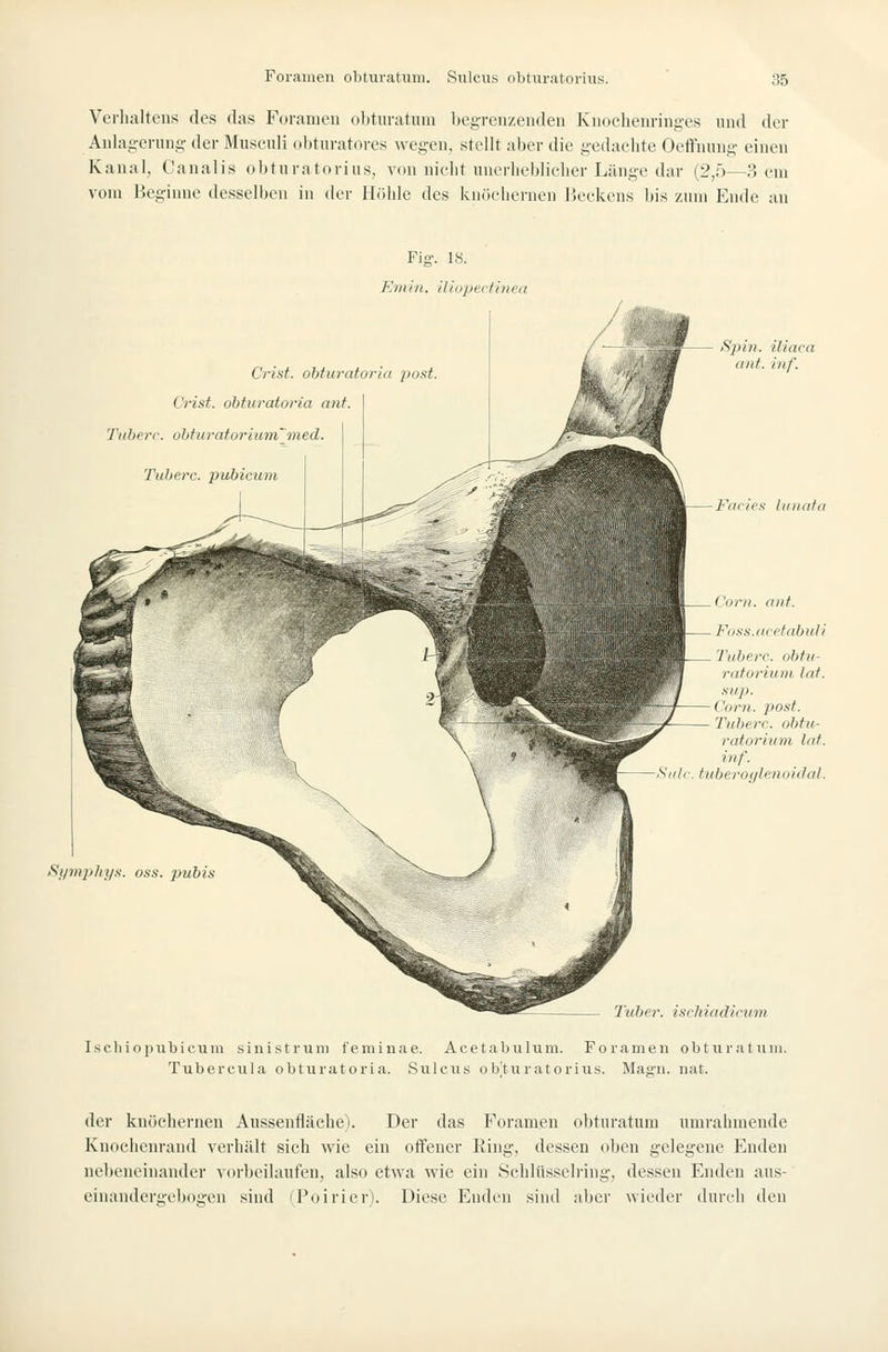 Verlialtens des das Foramen olituratimi begrenzenden Knoclienringes nnd der Anlagerung- der Musculi «lituratcn-es wegen, stellt aber die gedaclite Oeffnung einen Kanal, Canalis obtura torins, von nielit nnerlieblieiier Liinge dar (2,0—Sem vom Beginne desselben in der Höhle des kniiciierneii IJeekens bis zum Ende an Fig. 18. Em in. iliupecfinea Crist. obturaf.oriti post. Crist. obfurator/a mit. Tiiherc. ohturaforium'nied. Tiiherc. pubicum iSphi. itiara iinf. iiif. Kilcio: lininfd I 'iini. (Uli. Fuss.acffabuli Tubere. obtii- rnforium lat. Slip. Com. po.it. Tiiherc. obfu- raforiiim lat. inf. ^idc. tuberoijlcniiiilal. iSi/mplit/.s. oss. pubi.<i Tuher. i.ichiadiriim Ischiopubicuiii sinistrum feminae. Acetabnhim. Foramen obtnratum. Tubercnla obturatoria. Siilcns ob'turatoriiis. Maffn. nat. der knüehernen Aussenfläche). Der das Foramen obturatum umrahmende Knochenrand verhält sich wie ein offener Ring, dessen oben gelegene Enden nebeneinander vorbeilaufen, also etwa wie ein Schlüsselring, dessen Enden aus- einandergebogen sind iPoirier). Diese Enden sind aber wieder durch den