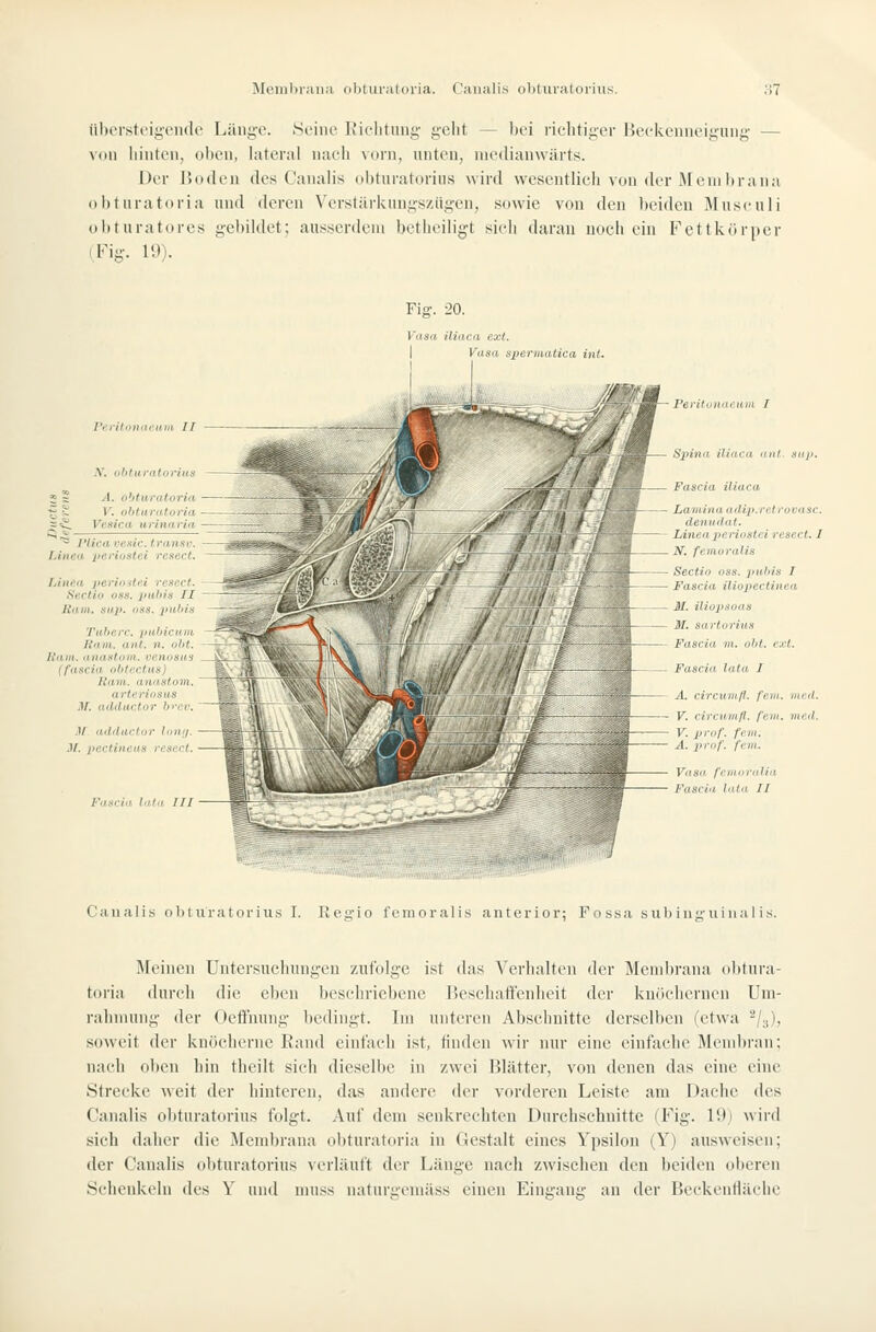 übersteigende Länge. Seine Rielitung geht — bei riclitiger Beckenneigung — von hinten^ oben, lateral naeb vorn, unten^ medianwärts. Der PxMlen des Canalis obturaturiiis wird wesentlicb von der iNFeni hrana obturatoria und deren Verslärknngs/.iigen, sowie von den beiden Museuli <»bturatores gebildet; ausserdem betheiligt sich daran noch ein Fettkörper (Fig. 19). Fig. 20. Vasa iliaca ext. Vasa spermatica int. Perifouiii'uiii IT '^ PIica veaic.tranac. Lineit periostei resect. Linea periostei resect. Sectio oss. puhis II Ram. sup. oss. piüiis Tiifici'C. /tnhicifui linm. ant. n. oht. Rain, anaatoui. venosus (fascia obiectiis) Ham. anastom. arteriosus M. adductor bt-cr. .1/ adductor lonif. M. pectineas resect. Fascia lata III ^Y Pei'ifvHill'lim I S2yina iliaca nnt. suj>. Fascia iliaca Lamina adip.ret rovasc. dentidat. lAneaperiostei resect. 1 N. femoralis Sectio oss. 2>ithi.s I Fascia iliopectinea M. iliopsoas Jf. sartoriua Fascia m, oht. ext. Fascia lata I A. circum/l. fem. med. - V. circiimfl. fitm. med. V. prof. fem. A. pn'of. fem. Vasa femoralia Fascia lata II Canalis obtiiratorius I. Regio femoralis anterior; Fossa siibinguiua 1 is. Meinen Untersuchungen zulolge ist das A'crbalten der Meniln*ana ohtura- toria durch die eben beschriebene Beschaffenheit der kuochcrnen Um- rahmung der Oeöuung bedingt. Im unteren Abschnitte derselben (etwa -/.i), soweit der knöcherne Rand einfach ist, linden wir nur eine einfiiehe Meml)ran; nach oben hin tbeilt sich dieselbe in zwei Blätter, von denen das eine eine Strecke weit der hinteren, das andere der vorderen Leiste am Dache des Canalis obturatorius folgt. Auf dem senkrechten Durchschnitte (Fig. lOj \\ird sich daher die Membrana ol)turatoria in Gestalt eines Ypsilon (Y) ausweisen; der Canalis obturatorius verläuft der Länge nach zwischen den beiden oberen Schenkeln des Y und muss naturgemäss einen Eingang an der Beckenllächc