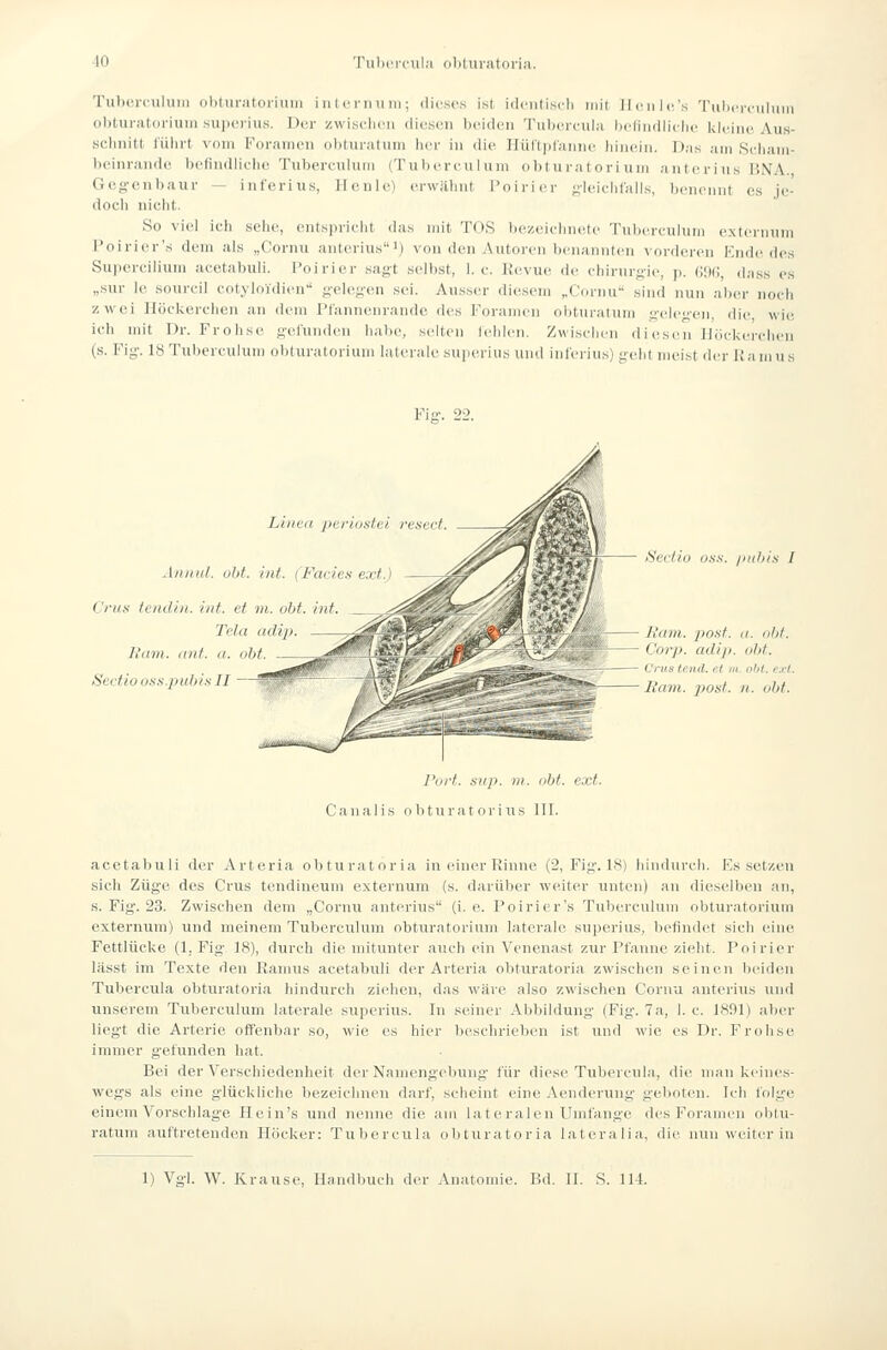 TubcrculuMi olduriitoriiiiii i ii 1 c rini in ; dii'.scs ist idculiscli iriil llculc's TuIkm-i-uIuiii ohturatoriuin sujici-ius. Di^r zwischen diesen beiden Tubcicul,-i licliiidliclu. Idi'ine Aus- ■sclmitt iülirt vom Foraiiien obtni-atum her in die Ilüftplannc hin('iii. Das am Scliani- beinrandc^ belindliclie Tuberenlum (Tubereulum obtui-atori um anterius ÜNA. Geg-enbaur — inferius, Heule) erwilliut l'niriei- f^-leielifalls, benennt es je- doch niclit. So viel ich sehe, entspricht (his mit TOS bezeiclnu'te 'l'nbcreulum extci-nuui Poirier's dem als „Cornu anteriius!) von den Autoren benannten ^■or(leren Kiidedes Supercilium acetabuli. I'oirier sagt selbst, I.e. Revue de ehirur>;ie, p. GiXI, da.ss es „sur Ic sourcil cotyloidien geleji-en sei. Aus.ser diesem „Cornu .sind nun aber noch zwei Ilöckerchen an dem Pl'annenrandc des Foramen obt\iratum y-elej^en, die, wie, ich mit Dr. Frohse gciunden habe, selten fehlen. Zwischen di esr n Jl.ii-ki'relien (s. Fig-. 18 Tubereulum obturatoriuni laterale superius und inlerius) geht mei.-t der Üamus Fiff. 22. Linea periuatul resecl. AnnIII. übt. int. (Facies ext.) Criifi Iciulin. int. et vi. obt. int. Tcla adip Ji'iiiii. iinf. u. obt. Sectio o.'<s.j)ii!>i.s II - Sectio O.SS. jiiiliis I Rani, po.st. a. nbt. Corp. adip. olit. C'ni8 tr.nä. et in. ohi. e.rt. liam. post. II. obt. Port. Slip. m. obt. ext. Canalis obturatorius III. acetabuli der Arteria obturatoria in einer Rinne (2, Fig. LS) hindurch. Es setzen sich Züge des Crus tendineum e.xternum (s. darüber weiter unten) an dieselben an, s. Fig'. 23. Zwischen dem „Cornu anterius (i. e. Poirier's Tubereulum obturatorium externum) und meinem Tubereulum obturatorium laterale superius, befindet sich eine Fettlücke (1. Fig. 18), durch die mitunter auch ein Venenast zur Pfanne zieht. Poirier lässt im Texte den Ramus acetabuli der Arteria obturatoria zwischen seinen beiden Tubercula obturatoria hindurch ziehen, das wäre also zwischen Cornu anterius und unserem Tubereulum laterale superius. In seiner Abbildung (Fig. 7 a, I.e. IHDl) aber liegt die Arterie offenbar so, wie es hier lieschrieben ist und wie es Dr. Frohse immer gefunden hat. Bei der Verschiedenheit der Naniengelning für diese Tubereul.-i, die man keines- wegs als eine glückliche bezeichnen darf, scheint eine Aenderung geboten. Ich folge einem VorschlagT. Hein's und nenne die am lateralen Umfange des Foramen obtu- ratum auftretenden Höcker: Tubercula obturatoria lateralia, die nun weiter in 1) Vgl. W. Krause, Handbuch der Anatonne. Bd. II. S. 114.