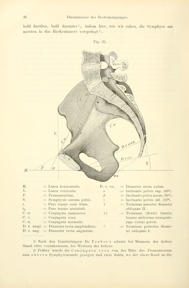 li;il(l (liiriihcr, hnid (laniiitiT' i, iii(l(!ni liier, wie wir sahen, die Sviiiplivse am meisten in das i>ceiveninn<ii' vdrspi'iiigt-j. Fia-. 25. H. = V. = P. S. t. = ti- = C, a. = C. V. = C. n. = D. r. aiiipl. = D. r. ang. = Linea liorizontalis. I). Linea verticalis. a Promontorium. ß Symphysis ossium piibis. y Pars tenuis ossis ilium. f Pars tenuis acetabuli. Conjug'ata anatomica. ff Conjugata vera. Coiijugata norrnalis. Diameter recta amplitudinis. * Diameter recta anaustiae. r. ex. = Diameter recta exitus. = Inclinatio pelvis sup. (60). = Inclinatio pelvis norm. (30). = Inclinatio pelvis inf. (12). = Terminus anterior diametri obliquae II. = Terminus (dextri lateris) baseos amborum triangulo- rum exitus pelvis. = Terminus posterior diame- tri obliquae I. 1) Nach den Ermittelungen Dr. F r o h s e's scheint bei Männern der tiefere Stand öfter vorzukonnnen, bei Weibern der höhere. 2) Früher wurde die Conjugata vera von der Mitte des Promontorium zum oberen Symphysenrande gezogen und zwar dahin, wo der obere Uand an die