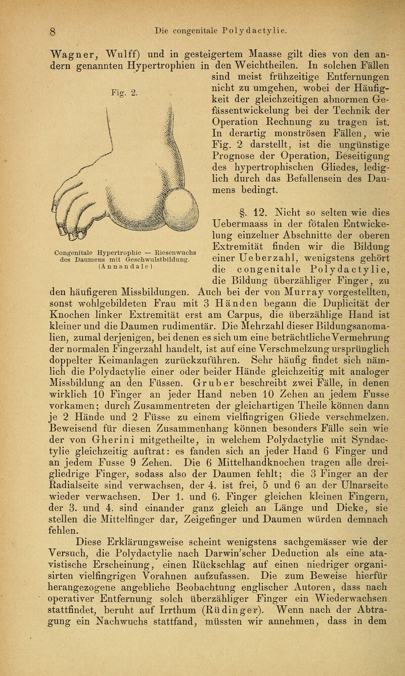 3 Die congenitale Polydactylie. Wagner, Wulff) und in gesteigertem Maasse gilt dies von den an- dern genannten Hypertrophien in den Weichtheilen. In solchen Fällen sind meist frühzeitige Entfernungen -p. 2 nicht zu umgehen, wobei der Häufig- keit der gleichzeitigen abnormen Ge- 1 I fässentwickelung bei der Technik der I M Operation Rechnung zu tragen ist. I M In derartig monströsen Fällen, wie j ^m Fig. 2 darstellt, ist die ungünstige y^ %i Prognose der Operation, Beseitigung /^ , M des hypertrophischen Gliedes, ledis;- /^^ ■ m 'W li^^ durch das Befallensein des Dau- A/^'Zi^ % ^r^\ ^®^^ bedingt. I / fl^m^,-- ^^ -=^1 §• ^^- ^^^^* ^^ selten wie dies tI xhs^^ ^^^^^^^^ß^^^ß^ Uebermaass in der fötalen Entwicke- ^^^^j lung einzelner Abschnitte der oberen Extremität finden wir die Bildung; Congenitale Hypertrophie — Kiesenwiichs . tt i i i • l i •• i des Daumens mit Geschmiistbiidung. emcr Ucberzahl, Wenigstens gehört '^'^^'^^^'^1^' die congenitale Poly dactylie, die Bildung überzähliger Finger, zu den häufigeren Missbildungen. Auch bei der von Murray vorgestellten, sonst wohlgebildeten Frau mit 3 Händen begann die Duplicität der Knochen linker Extremität erst am Carpus, die überzählige Hand ist kleiner und die Daumen rudimentär. Die Mehrzahl dieser Bildungsanoma- lien, zumal derjenigen, bei denen es sich um eine beträchtliche Vermehrung der normalen Fingerzahl handelt, ist auf eine Verschmelzung ursprünglich doppelter Keimaniagen zurückzuführen. Sehr häufig findet sich näm- lich die Polydactylie einer oder beider Hände gleichzeitig mit analoger Missbildung an den Füssen. Grub er beschreibt zwei Fälle, in denen wirklich 10 Finger an jeder Hand neben 10 Zehen an jedem Fusse vorkamen; durch Zusammentreten der gleichartigen Theile können dann je 2 Hände und 2 Füsse zu einem vielfingrigen Gliede verschmelzen. Beweisend für diesen Zusammenhang können besonders Fälle sein wie der von Gherini mitgetheilte, in welchem Polydactylie mit Syndac- tylie gleichzeitig auftrat: es fanden sich an jeder Hand 6 Finger und an jedem Fusse 9 Zehen. Die 6 Mittelhandknochen tragen alle drei- gliedrige Finger, sodass also der Daumen fehlt; die 3 Finger an der Radialseite sind verwachsen, der 4. ist frei, 5 und 6 an der Ulnarseite wieder verwachsen. Der 1. und 6. Finger gleichen kleinen Fingern, der 3. und 4. sind einander ganz gleich an Länge und Dicke, sie stellen die Mittelfinger dar, Zeigefinger und Daumen würden demnach fehlen. Diese Erklärungsweise scheint wenigstens sachgemässer wie der Versuch, die Polydactylie nach Darwin'scher Deduction als eine ata- vistische Erscheinung, einen Rückschlag auf einen niedriger organi- sirten vielfingrigen Vorahnen aufzufassen. Die zum Beweise hierfür herangezogene angebliche Beobachtung englischer Autoren, dass nach operativer Entfernung solch überzähliger Finger ein Wiederwachsen stattfindet, beruht auf Irrthum (Rü ding er). Wenn nach der Abtra- gung ein Nachwuchs stattfand, müssten wir annehmen, dass in dem