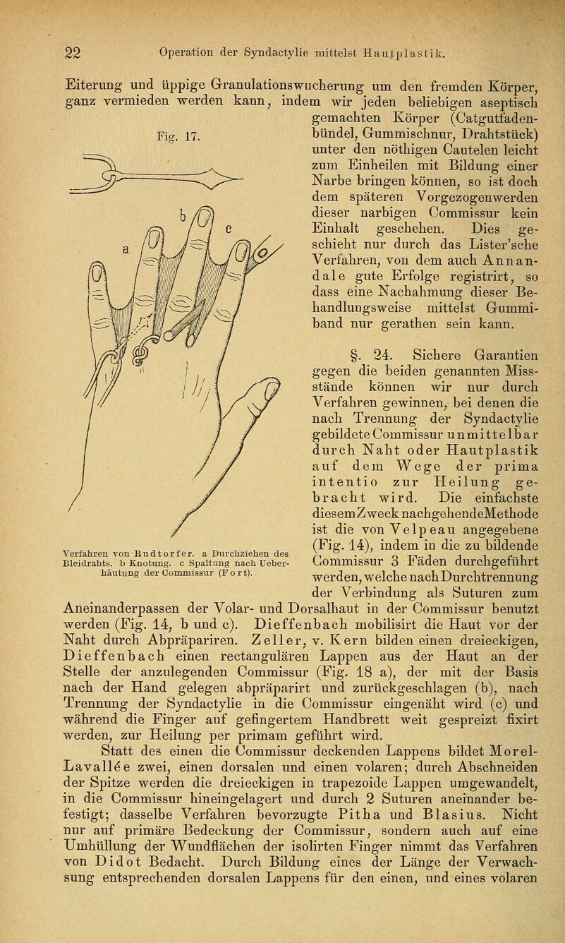 Eiterung und üppige Granulationswucherung um den fremden Körper, ganz vermieden werden kann, indem wir jeden beliebigen aseptisch gemachten Körper (Catgutfaden- Fig. 17. bündel, Gummischnur, Drahtstück) unter den nöthigen Cautelen leicht zum Einheilen mit Bildung einer Narbe bringen können, so ist doch dem späteren Vorgezogenwerden dieser narbigen Commissur kein Einhalt geschehen. Dies ge- schieht nur durch das Lister'sche Verfahren, von dem auch Annan- dale gute Erfolge registrirt, so dass eine Nachahmung dieser Be- handlungsweise mittelst Gummi- band nur gerathen sein kann. Verfahren von Rudtorfer. a Durcliziehen des Bleidrahts. b Knotung. c Spaltung nach. Ueber- häutung der Commissnr (Fort). §. 24. Sichere Garantien gegen die beiden genannten Miss- stände können wir nur durch Verfahren gewinnen, bei denen die nach Trennung der Syndactylie gebildete Commissur unmittelbar durch Naht oder Hautplastik auf dem Wege der prima intentio zur Heilung ge- bracht wird. Die einfachste diesemZweck nachgehendeMethode ist die vonVelpeau angegebene (Fig. 14), indem in die zu bildende Commissur 3 Fäden durchgeführt werden, welche nach Durchtrennung der Verbindung als Suturen zum Aneinanderpassen der Volar- und Dorsalhaut in der Commissur benutzt werden (Fig. 14, b und c). Dieffenbach mobilisirt die Haut vor der Naht durch Abpräpariren. Zell er, v. Kern bilden einen dreieckigen, Dieffenbach einen rectangulären Lappen aus der Haut an der Stelle der anzulegenden Commissur (Fig. 18 a), der mit der Basis nach der Hand gelegen abpräparirt und zurückgeschlagen (b), nach Trennung der Syndactylie in die Commissur eingenäht wird (c) und während die Finger auf gefingertem Handbrett weit gespreizt fixirt werden, zur Heilung per primam geführt wird. Statt des einen die Commissur deckenden Lappens bildet Morel- Lavall^e zwei, einen dorsalen und einen volaren; durch Abschneiden der Spitze werden die dreieckigen in trapezoide Lappen umgewandelt, in die Commissur hineingelagert und durch 2 Suturen aneinander be- festigt; dasselbe Verfahren bevorzugte Pitha und Blasius. Nicht nur auf primäre Bedeckung der Commissur, sondern auch auf eine Umhüllung der Wundflächen der isolirten Finger nimmt das Verfahren von Didot Bedacht. Durch Bildung eines der Länge der Verwach- sung entsprechenden dorsalen Lappens für den einen, und eines volaren