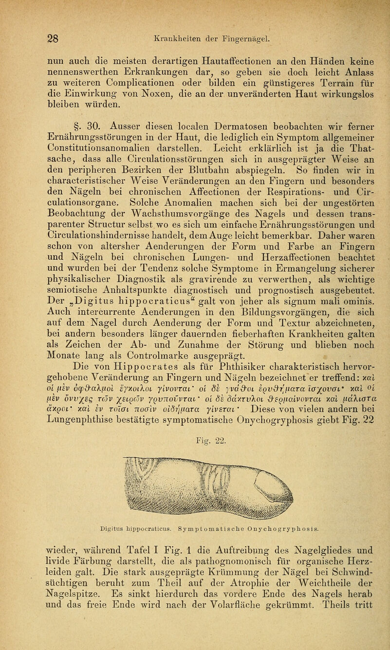 nun auch die meisten derartigen HautafFectionen an den Händen keine nennenswerthen Erkrankungen dar, so geben sie doch leicht Anlass zu weiteren Complicationen oder bilden ein günstigeres Terrain für die Einwirkung von Noxen, die an der unveränderten Haut wirkungslos bleiben würden. §. 30. Ausser diesen localen Dermatosen beobachten wir ferner Ernährungsstörungen in der Haut, die lediglich ein Symptom allgemeiner Constitutionsanomalien darstellen. Leicht erklärlich ist ja die That- sache, dass alle Circulationsstörungen sich in ausgeprägter Weise an den peripheren Bezirken der Blutbahn abspiegeln. So finden wir in characteristischer Weise Veränderungen an den Fingern und besonders den Nägeln bei chronischen Affectionen der Respirations- und Cir- culationsorgane. Solche Anomalien machen sich bei der ungestörten Beobachtung der Wachsthumsvorgänge des Nagels und dessen trans- parenter Structur selbst wo es sich um einfache Ernährungsstörungen und Circulationshindernisse handelt, dem Auge leicht bemerkbar. Daher waren schon von altersher Aenderungen der Form und Farbe an Fingern und Nägeln bei chronischen Lungen- und HerzafFectionen beachtet und wurden bei der Tendenz solche Symptome in Ermangelung sicherer physikalischer Diagnostik als gravirende zu verwerthen, als wichtige semiotische Anhaltspunkte diagnostisch und prognostisch ausgebeutet. Der „Digitus hippocraticus galt von jeher als signum mali ominis. Auch intercurrente Aenderungen in den Bildungsvorgängen, die sich auf dem Nagel durch Aenderung der Form und Textur abzeichneten, bei andern besonders länger dauernden fieberhaften Krankheiten galten als Zeichen der Ab- und Zunahme der Störung und blieben noch Monate lang als Controlmarke ausgeprägt. Die von Hippocrates als für Phthisiker charakteristisch hervor- gehobene Veränderung an Fingern und Nägeln bezeichnet er trefiend: xal ol [.lEv dcpd-aXi-iol synoiXoi ylvovrai' oi ds yvd-d'OL egv-d^r^iara lojovoi' xol ^l l-iEv övv^sg To5v j^siQcöv yQvnovvrai' oi de öävtruXot d-sgj.iaivovrai xal f.id'ki.aTa äxQOi' yial SV roXat, noalv otÖTjfJcjra yivsTai' Diese von vielen andern bei Lungenphthise bestätigte symptomatische Onychogryphosis giebt Fig. 22 Fig. 22. Digitus hippocraticus. Symptomatisclae Onychogryphosis. wieder, während Tafel I Fig. 1 die Auftreibung des Nagelgliedes und livide Färbung darstellt, die als pathognomonisch für organische Herz- leiden galt. Die stark ausgeprägte Krümmung der Nägel bei Schwind- süchtigen beruht zum Theil auf der Atrophie der Weichtheile der Nagelspitze. Es sinkt hierdurch das vordere Ende des Nagels herab und das freie Ende wird nach der Volarfläche gekrümmt. Theils tritt