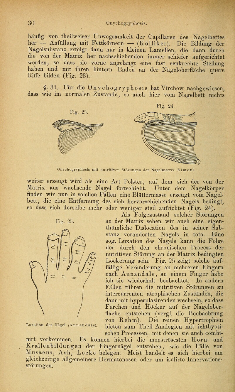 häufig von theilweiser Unwegsamkeit der Capillaren des Nagelbettes her — Anfüllung mit Fettkörnern — (Kölliker). Die Bildung der Nagelsubstanz erfolgt dann nur in kleinen Lamellen, die dann durch die von der Matrix her nachschiebenden immer schiefer aufgerichtet werden, so dass sie vorne angelangt eine fast senkrechte Stellung haben und mit ihren hintern Enden an der Nageloberfläche quere Riffe bilden (Fig. 23). §. 31. Für die Onychogryphosis hat Virchow nachgewiesen^ dass wie im normalen Zustande, so auch hier vom Nagelbett nichts Pig. 2f Fig. 24. Fig. 25. Onychogryphosis mit mitritiven Störungen der Nagelmatrix (Simon). weiter erzeugt wird als eine Art Polster, auf dem sich der von der Matrix aus wachsende Nagel fortschiebt. Unter dem Nagelkörper finden wir nun in solchen Fällen eine Blättermasse erzeugt vom Nagel- bett, die eine Entfernung des sich hervorschiebenden Nagels bedingt^ so dass sich derselbe mehr oder weniger steil aufrichtet (Fig. 24). Als Folgezustand solcher Störungen an der Matrix sehen wir auch eine eigen- thümliche Dislocation des in seiner Sub- stanz veränderten Nagels in toto. Eine sog. Luxation des Nagels kann die Folge der durch den chronischen Process der nutritiven Störung an der Matrix bedingten Lockerung sein. Fig. 25 zeigt solche auf- fällige Veränderung an mehreren Fingern nach Annandale, an einem Finger habe ich sie wiederholt beobachtet. In andern Fällen führen die nutritiven Störungen zu intercurrenten atrophischen Zuständen, die dann mit hyperplasirenden wechseln, so dass Furchen und Höcker auf der Nagelober- fläche entstehen (vergl. die Beobachtung von Rehm). Die reinen Hypertrophien bieten zum Theil Analogien mit ichthyoti- schen Processen, mit denen sie auch combi- nirt vorkommen. Es können hierbei die monströsesten Hörn- und Krallenbildungen der Fingernägel entstehen, wie die Fälle von Musaeus, Ash, Locke belegen. Meist handelt es sich hierbei um gleichzeitige allgemeinere Dermatonosen oder um isolirte Innervations- störungen. Luxation der Nägel CA nn and als).