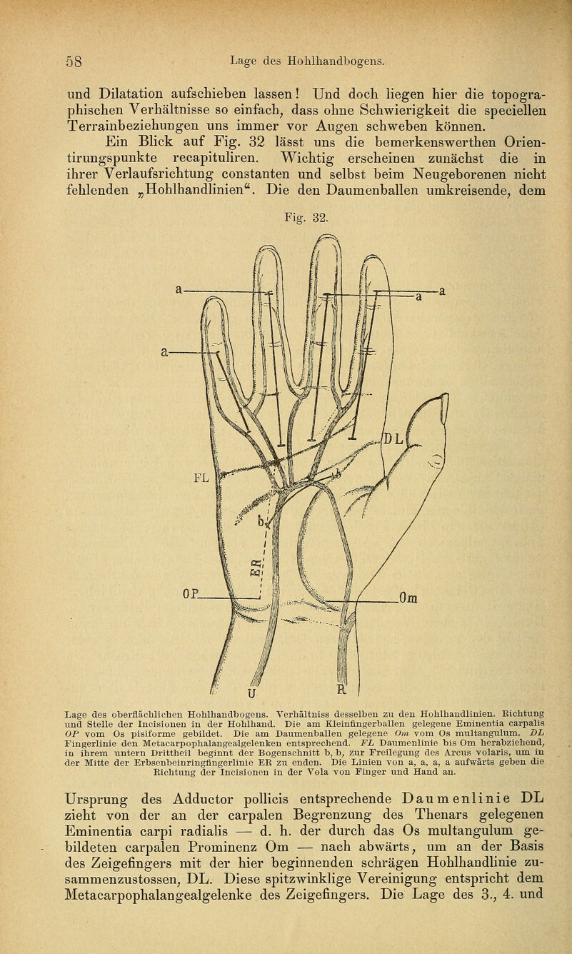 und Dilatation aufschieben lassen! Und doch liegen hier die topogra- phischen Verhältnisse so einfach, dass ohne Schwierigkeit die specieilen Terrainbeziehungen uns immer vor Augen schweben können. Ein Blick auf Fig. 32 lässt uns die bemerkenswerthen Orien- tirungspunkte recapituliren. Wichtig erscheinen zunächst die in ihrer Verlaufsrichtung constanten und selbst beim Neugeborenen nicht fehlenden „Hohlhandlinien. Die den Daumenballen umkreisende, dem Fig. 32. Lage des oberflächlichen Hohlhandbogens. Verhältniss desselben zu den Hohlhandlinien. Kichtung lind Stelle der Incislonen in der Hohlhand. Die am Eleinfingerballen gelegene Eminentia carpalis OP vom Os pisiforme gebildet. Die am Daumenballen gelegene Om vom Os multangulum. DL ringerlinie den Metacarpophalangealgelenken entsprechend. FL Daumenlinie bis Om herabziehend, in ihrem untern Drittheil beginnt der Bogenschnitt b, b, zur Freilegung des Arcus volaris, um in der Mitte der Erbseubeinringfingerlinie Eß zu enden. Die Linien von a, a, a, a aufwärts geben die Kichtung der Incisionen in der Vola von Finger und Hand an. Ursprung des Adductor poUicis entsprechende Daumenlinie DL zieht von der an der carpalen Begrenzung des Thenars gelegenen Eminentia carpi radialis — d. h. der durch das Os multangulum ge- bildeten carpalen Prominenz Om — nach abwärts, um an der Basis des Zeigefingers mit der hier beginnenden schrägen Hohlhandlinie zu- sammenzustossen, DL. Diese spitzwinklige Vereinigung entspricht dem Metacarpophalangealgelenke des Zeigefingers. Die Lage des 3., 4. und