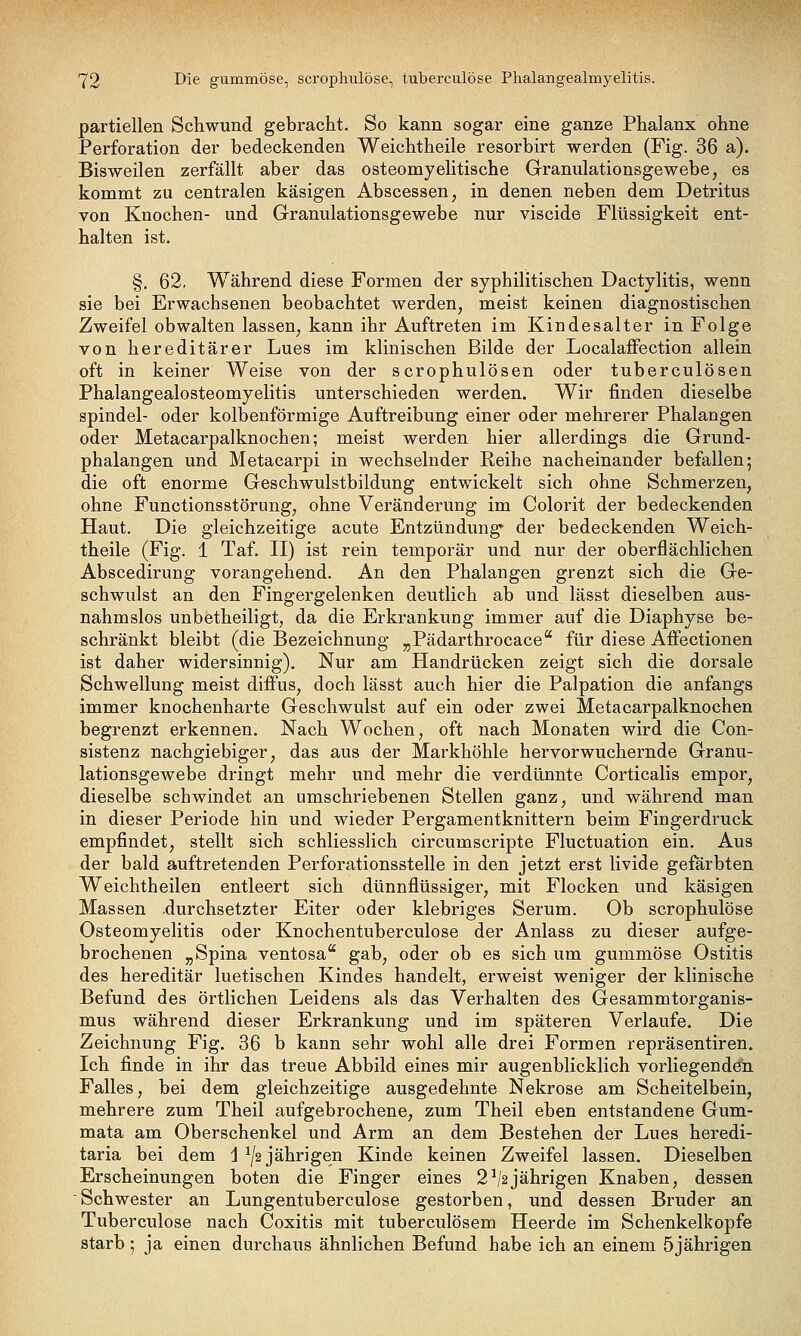 partiellen Schwund gebracht. So kann sogar eine ganze Phalanx ohne Perforation der bedeckenden Weichtheile resorbirt werden (Fig. 36 a). Bisweilen zerfällt aber das osteomyelitische Granulationsgewebe, es kommt zu centralen käsigen Abscessen, in denen neben dem Detritus von Knochen- und Granulationsgewebe nur viscide Flüssigkeit ent- halten ist. §. 62, Während diese Formen der syphilitischen Dactylitis, wenn sie bei Erwachsenen beobachtet werden, meist keinen diagnostischen Zweifel obwalten lassen, kann ihr Auftreten im Kindesalter in Folge von hereditärer Lues im klinischen Bilde der LocalafFection allein oft in keiner Weise von der scrophulösen oder tuberculösen Phalangealosteomyelitis unterschieden werden. Wir finden dieselbe Spindel- oder kolbenförmige Auftreibung einer oder mehrerer Phalangen oder Metacarpalknochen; meist werden hier allerdings die Grund- phalangen und Metacarpi in wechselnder Reihe nacheinander befallen; die oft enorme Geschwulstbildung entwickelt sich ohne Schmerzen, ohne Functionsstörung, ohne Veränderung im Colorit der bedeckenden Haut. Die gleichzeitige acute Entzündung* der bedeckenden Weich- theile (Fig. 1 Taf. II) ist rein temporär und nur der oberflächlichen Abscedirung vorangehend. An den Phalangen grenzt sich die Ge- schwulst an den Fingergelenken deutlich ab und lässt dieselben aus- nahmslos unbetheiligt, da die Erkrankung immer auf die Diaphyse be- schränkt bleibt (die Bezeichnung „Pädarthrocace für diese Affectionen ist daher widersinnig). Nur am Handrücken zeigt sich die dorsale Schwellung meist diffus, doch lässt auch hier die Palpation die anfangs immer knochenharte Geschwulst auf ein oder zwei Metacarpalknochen begrenzt erkennen. Nach Wochen, oft nach Monaten wird die Con- sistenz nachgiebiger, das aus der Markhöhle hervorwuchernde Granu- lationsgewebe dringt mehr und mehr die verdünnte Corticalis empor, dieselbe schwindet an umschriebenen Stellen ganz, und während man in dieser Periode hin und wieder Pergamentknittern beim Fingerdruck empfindet, stellt sich schliesslich circumscripte Fluctuation ein. Aus der bald auftretenden Perforationsstelle in den jetzt erst livide gefärbten Weichtheilen entleert sich dünnflüssiger, mit Flocken und käsigen Massen .durchsetzter Eiter oder klebriges Serum. Ob scrophulöse Osteomyelitis oder Knochentuberculose der Anlass zu dieser aufge- brochenen „Spina ventosa gab, oder ob es sich um gummöse Ostitis des hereditär luetischen Kindes handelt, erweist weniger der klinische Befund des örtlichen Leidens als das Verhalten des Gesammtorganis- mus während dieser Erkrankung und im späteren Verlaufe. Die Zeichnung Fig. 36 b kann sehr wohl alle drei Formen repräsentiren. Ich finde in ihr das treue Abbild eines mir augenblicklich vorliegenden Falles, bei dem gleichzeitige ausgedehnte Nekrose am Scheitelbein, mehrere zum Theil aufgebrochene, zum Theil eben entstandene Gum- mata am Oberschenkel und Arm an dem Bestehen der Lues heredi- taria bei dem j ^/2 jährigen Kinde keinen Zweifel lassen. Dieselben Erscheinungen boten die Finger eines 2^2jährigen Knaben, dessen Schwester an Lungentuberculose gestorben, und dessen Bruder an Tuberculose nach Coxitis mit tuberculösem Heerde im Schenkelkopfe starb; ja einen durchaus ähnlichen Befund habe ich an einem 5jährigen