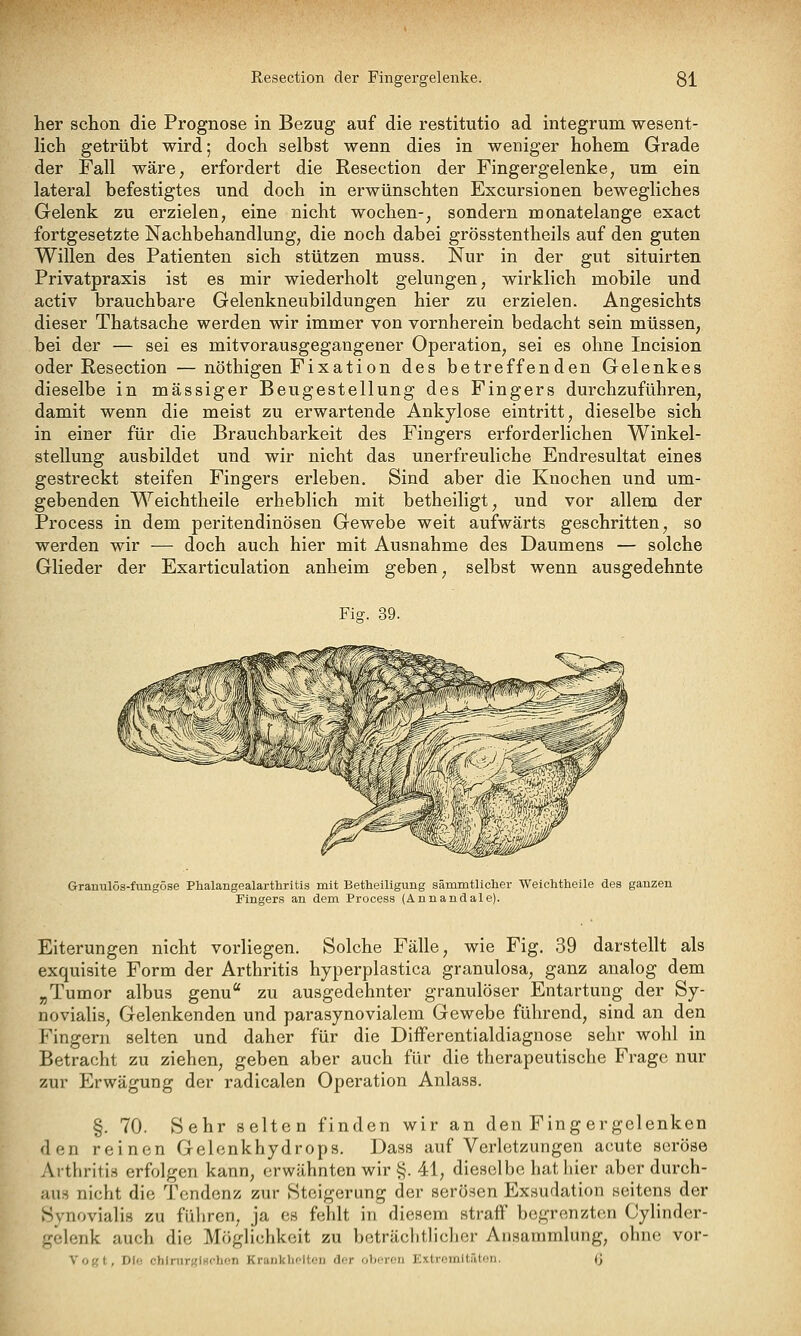 her schon die Prognose in Bezug auf die restitutio ad integrum wesent- lich getrübt wird; doch selbst wenn dies in weniger hohem Grade der Fall wäre, erfordert die Resection der Fingergelenke, um ein lateral befestigtes und doch in erwünschten Excursionen bewegliches Gelenk zu erzielen, eine nicht wochen-, sondern monatelange exact fortgesetzte Nachbehandlung, die noch dabei grösstentheils auf den guten Willen des Patienten sich stützen muss. Nur in der gut situirten Privatpraxis ist es mir wiederholt gelungen, wirklich mobile und activ brauchbare Gelenkneubildungen hier zu erzielen. Angesichts dieser Thatsache werden wir immer von vornherein bedacht sein müssen, bei der — sei es mitvorausgegangener Operation, sei es ohne Incision oder Resection — nöthigen Fixation des betreffenden Gelenkes dieselbe in massiger Beugestellung des Fingers durchzuführen, damit wenn die meist zu erwartende Ankylose eintritt, dieselbe sich in einer für die Brauchbarkeit des Fingers erforderlichen Winkel- stellung ausbildet und wir nicht das unerfreuliche Endresultat eines gestreckt steifen Fingers erleben. Sind aber die Knochen und um- gebenden Weichtheile erheblich mit betheiligt, und vor allem der Process in dem peritendinösen Gewebe weit aufwärts geschritten, so werden wir — doch auch hier mit Ausnahme des Daumens — solche Glieder der Exarticulation anheim geben, selbst wenn ausgedehnte Fig. 39. Grautilös-fimgöse Phalangealarthritis mit Betheiligung sämmtlicher Weichtheile des ganzen Fingers an dem Process (Annandale). Eiterungen nicht vorliegen. Solche Fälle, wie Fig. 39 darstellt als exquisite Form der Arthritis hyperplastica granulosa, ganz analog dem „Tumor albus genu zu ausgedehnter granulöser Entartung der Sy- novialis, Gelenkenden und parasynovialem Gewebe führend, sind an den Fingern selten und daher für die Differentialdiagnose sehr wohl in Betracht zu ziehen, geben aber auch für die therapeutische Frage nur zur Erwägung der radicalen Operation Anlass. §. 70. Sehr selten finden wir an den Fing ergelenken den reinen Gelonkhydrops. Dass auf Verletzungen acute seröse Arthritis erfolgen kann, erwähnten wir §. 41, dieselbe hat hier aber durch- au.s nicht die Tendenz zur Steigerung der serösen Exsudation seitens der Synovialis zu fiilircn, ja es fehlt in diesem straff begrenzten Cylinder- gelenk auch die Möglichkeit zu beträclitliclicr Ansammlung, ohne vor- Vogt, DIo chlrurfflHchon Kranklioltci) dor oboroii Extromltüton. Q