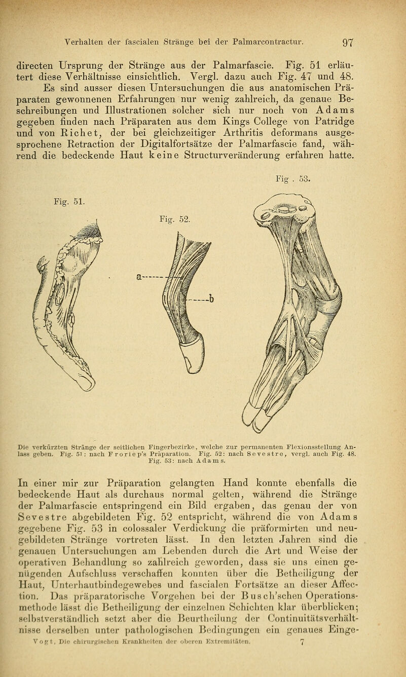 directen Ursprung der Stränge aus der Palmarfascie. Fig. 51 erläu- tert diese Verhältnisse einsichtlich. Vergl. dazu auch Fig. 47 und 48. Es sind ausser diesen Untersuchungen die aus anatomischen Prä- paraten gewonnenen Erfahrungen nur wenig zahlreich, da genaue Be- schreibungen und Illustrationen solcher sich nur noch von Adams gegeben finden nach Präparaten aus dem Kings College von Patridge und von Riebet, der bei gleichzeitiger Arthritis deformans ausge- sprochene Retraction der Digitalfortsätze der Palmarfascie fand, wäh- rend die bedeckende Haut keine Structurveränderung erfahren hatte. Fig. 51. Fig . 53. Fig. 52. Die verkürzten Stränge der seitliclien Fingerbezirke, welclie zur permanenten Flexionsstellung An- lass geben. Fig. 5i : nach Froriep's Präparatiou. Fig. 52: nach. Sevestre, vergl. auch Fig. 48. Fig. 53: nach Adams. In einer mir zur Präparation gelangten Hand konnte ebenfalls die bedeckende Haut als durchaus normal gelten, während die Stränge der Palmarfascie entspringend ein Bild ergaben, das genau der von Sevestre abgebildeten Fig. 52 entspricht, während die von Adams gegebene Fig. 53 in colossaler Verdickung die präformirten und neu- gebildeten Stränge vortreten lässt. In den letzten Jaliren sind die genauen Untersuchungen am Lebenden durch die Art und Weise der operativen Behandlung so zahlreich geworden, dass sie uns einen ge- nügenden Aufschiuss verschaffen konnten über die Betheiligung der Haut, Unterhautbindegewebes und fascialen Fortsätze an dieser AfFec- tion. Das präparatorische Vorgehen bei der Busch'schen Operations- raethode lässt die Betheiligung der einzelnen Schichten klar überblicken; selbstverständlich setzt aber die Beurtiieilung der (Jontinuitätsverhält- nisse derselben unter pathologischen Bedingungen ein genaues Einge- Vogt, Die chlrurglHchen Krankheiten dor oberen Extromltüten, 7