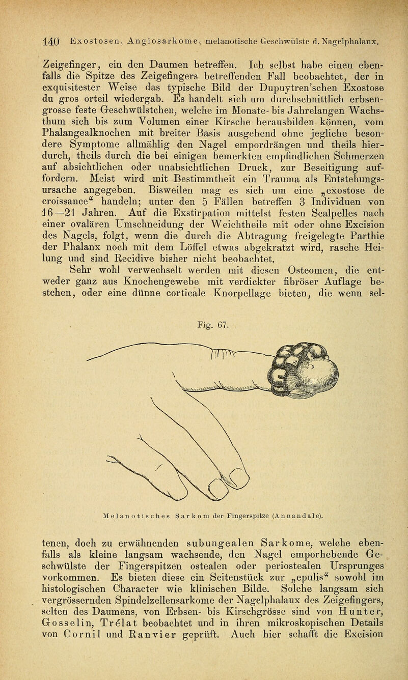 Zeigefinger, ein den Daumen betreffen. Ich selbst habe einen eben- falls die Spitze des Zeigefingers betreffenden Fall beobachtet, der in exquisitester Weise das typische Bild der Dupuytren'schen Exostose du gros orteil wiedergab. Es handelt sich um durchschnittlich erbsen- grosse feste Geschwülstchen, welche im Monate- bis Jahrelangen Wachs- thum sich bis zum Volumen einer Kirsche herausbilden können, vom Phalangealknochen mit breiter Basis ausgehend ohne jegliche beson- dere Symptome allmählig den Nagel empordrängen und theils hier- durch, theils durch die bei einigen bemerkten empfindlichen Schmerzen auf absichtlichen oder unabsichtlichen Druck, zur Beseitigung auf- fordern. Meist wird mit Bestimmtheit ein Trauma als Entstehungs- ursache angegeben. Bisweilen mag es sich um eine „exostose de croissance handeln; unter den 5 Fällen betreffen 3 Individuen von 16—21 Jahren. Auf die Exstirpation mittelst festen Scalpelles nach einer ovalären Umschneidung der Weichtheile mit oder ohne Excision des Nagels, folgt, wenn die durch die Abtragung freigelegte Parthie der Phalanx noch mit dem Löffel etwas abgekratzt wird, rasche Hei- lung und sind Recidive bisher nicht beobachtet. Sehr wohl verwechselt werden mit diesen Osteomen, die ent- weder ganz aus Knochengewebe mit verdickter fibröser Auflage be- stehen, oder eine dünne corticale Knorpellage bieten, die wenn sel- Fig. 67. Melanotisches Sarkom der Fingerspitze (Annandale). tenen, doch zu erwähnenden subungealen Sarkome, welche eben- falls als kleine langsam wachsende, den Nagel emporhebende Ge- schwülste der Fingerspitzen ostealen oder periostealen Ursprunges vorkommen. Es bieten diese ein Seitenstück zur „epulis sowohl im histologischen Character wie klinischen Bilde, Solche langsam sich vergrössernden Spindelzellensarkome der Nagelphalaux des Zeigefingers, selten des Daumens, von Erbsen- bis Kirschgrösse sind von Hunt er, Gosselin, Trdlat beobachtet und in ihren mikroskopischen Details von Cornil und Ran vi er geprüft. Auch hier schafft die Excision