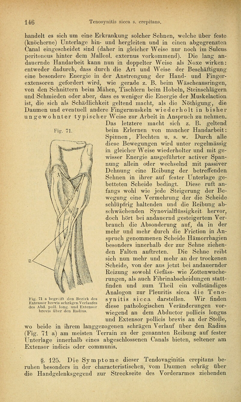 Fig. 71. handelt es sich um eine Erkrankung solcher Sehnen, welche über feste (knöcherne) Unterlage hin- und hergleiten und in einen abgegrenzten Canal eingescheidet sind (daher in gleicher Weise nur noch im Sulcus peritoneus hinter dem Malleol. externus vorkommend). Die lang an- dauernde Handarbeit kann nun in doppelter Weise als Noxe wirken: entweder dadurch, dass durch die Art und Weise der Beschäftigung eine besondere Energie in der Anstrengung der Hand- und Finger- extensoren gefordert wird, wie gerade z. B. beim Wäscheausringen, von den Schnittern beim Mähen, Tischlern beim Hobeln, Steinschlägern und Schmieden oder aber, dass es weniger die Energie der Muskelaction ist, die sich als Schädlichkeit geltend macht, als die Nöthigung, die Daumen und eventuell andere Fingermuskeln wiederholt in bisher ungewohnter typischer Weise zur Arbeit in Anspruch zu nehmen. Das letztere macht sich z. B. geltend beim Erlernen von mancher Handarbeit i Spinnen, Flechten u. s. w. Durch alle diese Bewegungen wird unter regelmässig in gleicher Weise wiederholter und mit ge- wisser Energie ausgeführter activer Span- nung allein oder wechselnd mit passiver Dehnung eine Reibung der betreffenden Sehnen in ihrer auf fester Unterlage ge- betteten Scheide bedingt. Diese ruft an- fangs wohl wie jede Steigerung der Be- wegung eine Vermehrung der die Scheide schlüpfrig haltenden und die Reibung ab- schwächenden Synovialflüssigkeit hervor, doch hört bei andauernd gesteigertem Ver- brauch die Absonderung auf, da in der mehr und mehr durch die Friction in An- spruch genommenen Scheide Hämorrhagien besonders innerhalb der zur Sehne ziehen- den Falten auftreten. Die Sehne reibt sich nun mehr und mehr an der trockenen Scheide, von der aus jetzt bei andauernder Reizung sowohl Gefäss- wie Zottenwuche- rungen, als auch Fibrinabscheidungen statt- finden und zum Theil ein vollständiges Analogen zur Pleuritis sicca die Teno- synitis sicca darstellen. Wir finden diese pathologischen Veränderungen vor- wiegend an dem Abductor pollicis longus und Extensor pollicis brevis an der Stelle, wo beide in ihrem langgezogenen schrägen Verlauf über den Radius (Fig. 71 a) am meisten Terrain zu der genannten Reibung auf fester Unterlage innerhalb eines abgeschlossenen Canals bieten, seltener am Extensor indicis oder communis. Fig. 71 a begreift den Bezirk des Extensor brevis schrägen Verlaufes des Abd. poll. long, und Extensor brevis über den Radius. §. 125. Die Symptome dieser Tendovaginitis crepitans be- ruhen besonders in der characteristischen, vom Daumen schräg über die Handgelenksgegend zur Streckseite des Vorderarmes ziehenden