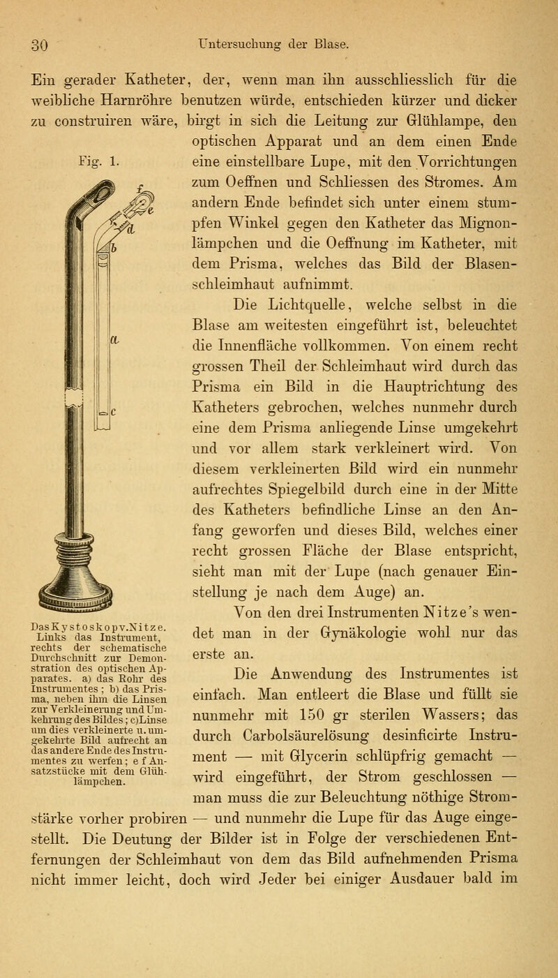 Fiff. 1. Ein gerader Katheter, der, wenn man ihn ausschliesshch für die weibliche Harnröhre benutzen würde, entschieden kürzer und dicker zu construiren wäre, bii'gt in sich die Leitung zur Glühlampe, den optischen Apparat und an dem einen Ende eine einstellbare Lupe, mit den Vorrichtungen zum Oeffnen und Schliessen des Stromes. Am andern Ende befindet sich unter einem stum- pfen Winkel gegen den Katheter das Mignon- lämpchen und die Oeffnung im Katheter, mit dem Prisma, welches das Bild der Blasen- schleimhaut aufnimmt. Die Lichtquelle, welche selbst in die Blase am weitesten eingeführt ist, beleuchtet die Innenfläche vollkommen. Von einem recht grossen Theil der Schleimhaut wird durch das Prisma ein Bild in die Hauptrichtung des Katheters gebrochen, welches nunmehr durch eine dem Prisma anliegende Linse umgekehrt und vor allem stark verkleinert wird. Von diesem verkleinerten Bild wird ein nunmehr aufrechtes Spiegelbild durch eine in der Mitte des Katheters befindhche Linse an den An- fang geworfen und dieses Bild, welches einer recht grossen Fläche der Blase entspricht, sieht man mit der Lupe (nach genauer Ein- stellung je nach dem Auge) an. Von den drei Instrumenten Nitze's wen- det man in der Gynäkologie wohl nur das erste an. Die Anwendung des Instrumentes ist einfach. Man entleert die Blase und füllt sie nunmehr mit 150 gr sterilen Wassers; das durch Carbolsäurelösung desinficirte Instru- ment — mit Glycerin schlüpfrig gemacht — wird eingeführt, der Strom geschlossen — man muss die zur Beleuchtung nöthige Strom- stärke vorher probiren — und nunmehr die Lupe für das Auge einge- stellt. Die Deutung der Bilder ist in Folge der verschiedenen Ent- fernungen der Schleimhaut von dem das Bild aufnehmenden Prisma nicht immer leicht, doch wird Jeder bei einiger Ausdauer bald im DasKystoskopv.Nitze. Links das Instrumeut, rechts der schematische Dnrchsc-huitt zur Demon- stration des optischen Ap- parates, a) das Eohr des Instrumentes ; h) das Pris- ma, neben ihm die Linsen zur Verkleinening und Tm- kehruug des Bildes; oLinse um dies verkleinerte u.um- gekehi'te Bild aufrecht an das andere Ende des Instru- mentes zu werfen; e f Au- satzstücke mit dem Glüh- lämpchen.