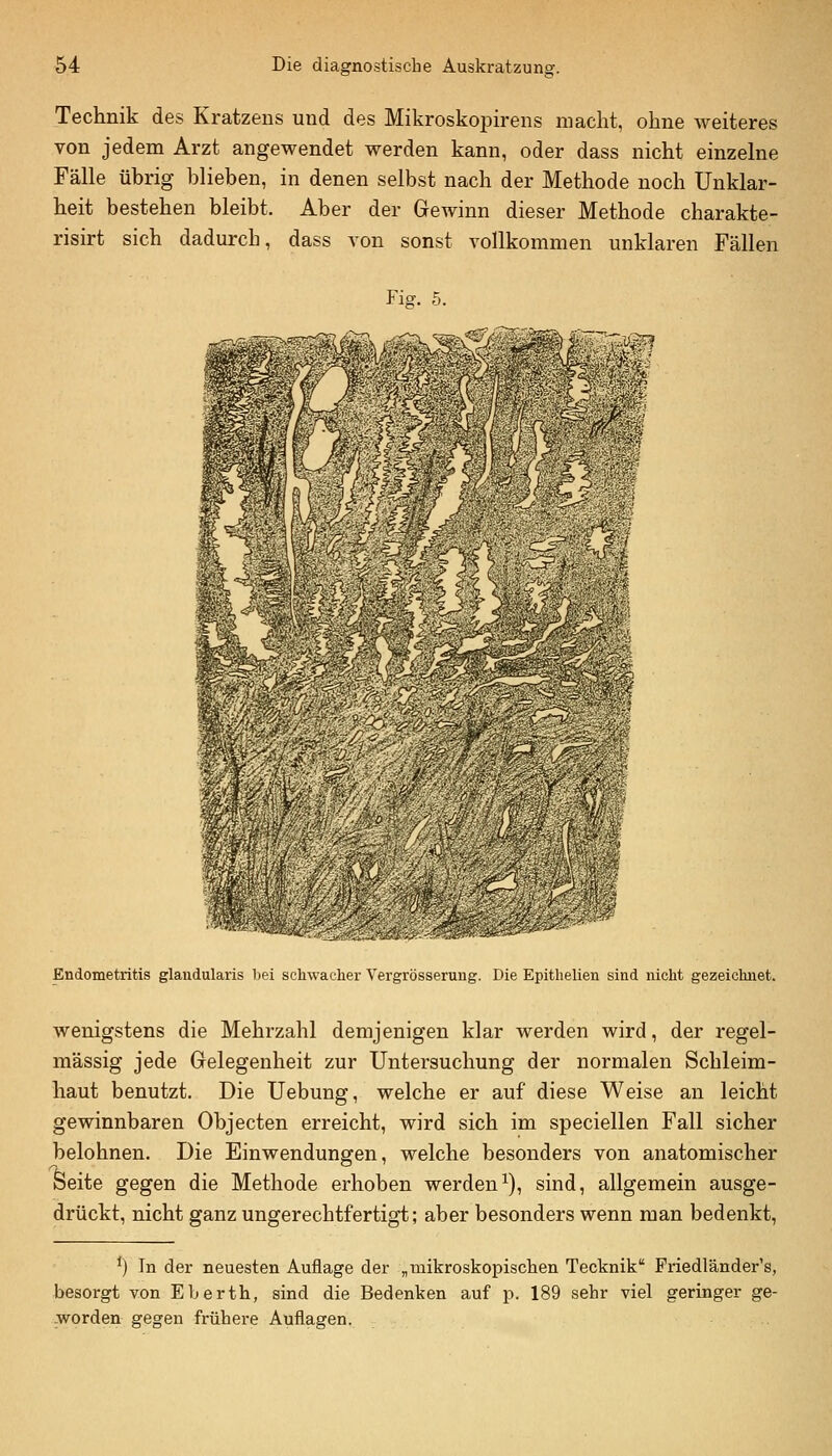 Technik des Kratzens und des Mikroskopirens macht, ohne weiteres von jedem Arzt angewendet werden kann, oder dass nicht einzelne Fälle übrig blieben, in denen selbst nach der Methode noch Unklar- heit bestehen bleibt. Aber der Gewinn dieser Methode charakte- risirt sich dadurch, dass von sonst vollkommen unklaren Fällen Fig. 5. Endometritis glandularis bei schwacher Vergrösseruug. Die Epithelien sind nicht gezeichnet. wenigstens die Mehrzahl demjenigen klar werden wird, der regel- mässig jede Gelegenheit zur Untersuchung der normalen Schleim- haut benutzt. Die Uebung, welche er auf diese Weise an leicht gewinnbaren Objecten erreicht, wird sich im speciellen Fall sicher belohnen. Die Einwendungen, welche besonders von anatomischer Seite gegen die Methode erhoben werden^), sind, allgemein ausge- drückt, nicht ganz ungerechtfertigt; aber besonders wenn man bedenkt. ^) In der neuesten Auflage der „mikroskopischen Tecknik' Priedländer's, besorgt von Eberth, sind die Bedenken auf p. 189 sehr viel geringer ge- -worden gegen frühere Auflagen.
