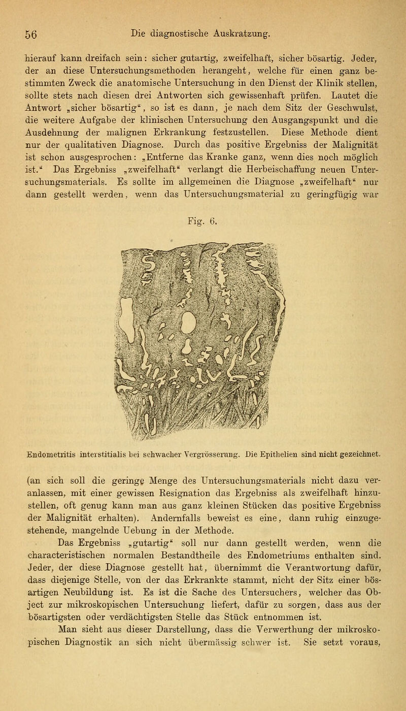 hierauf kann dreifach sein: sicher gutartig, zweifelhaft, sicher bösartig. Jeder, der an diese Untersuchungsmethoden herangeht, welche für einen ganz be- stimmten Zweck die anatomische Untersuchung in den Dienst der Klinik stellen, sollte stets nach diesen drei Antworten sich gewissenhaft prüfen. Lautet die Antwort ,sicher bösartig, so ist es dann, je nach dem Sitz der Geschwulst, die weitere Aufgabe der klinischen Untersuchung den Ausgangspunkt und die Ausdehnung der malignen Erkrankung festzustellen. Diese Methode dient nur der qualitativen Diagnose. Durch das positive Ergebniss der Malignität ist schon ausgesprochen: „Entferne das Kranke ganz, wenn dies noch möglich ist. Das Ergebniss „zweifelhaft verlangt die Herbeischaffung neuen Unter- suchungsmaterials. Es sollte im allgemeinen die Diagiaose „zweifelhaft nur dann gestellt werden, wenn das Untersuchungsmaterial zu geringfügig war Fig. 6. h r ^-^5-; Endometritis interstitialis bei schwacher Vergrösserung. Die Epitlielien sind nicht gezeichnet. (an sich soll die geringe Menge des Untersuchungsmaterials nicht dazu ver- anlassen, mit einer gewissen Resignation das Ergebniss als zweifelhaft hinzu- stellen, oft genug kann man aus ganz kleinen Stücken das positive Ergebniss der Malignität erhalten). Andernfalls beweist es eine, dann ruhig einzuge- stehende, mangelnde Uebung in der Methode. Das Ergebniss „gutartig soll nur dann gestellt werden, wenn die characteristischen normalen Bestandtheile des Endometriums enthalten sind. Jeder, der diese Diagnose gestellt hat, übernimmt die Verantwortung dafür, dass diejenige Stelle, von der das Erkrankte stammt, nicht der Sitz einer bös- artigen Neubildung ist. Es ist die Sache des Untersuchers, welcher das Ob- ject zur mikroskopischen Untersuchung liefert, dafür zu sorgen, dass aus der bösartigsten oder verdächtigsten Stelle das Stück entnommen ist. Man sieht aus dieser Darstellung, dass die Verwerthung der mikrosko- pischen Diagnostik an sich nicht übermässig schwer ist. Sie setzt voraus.