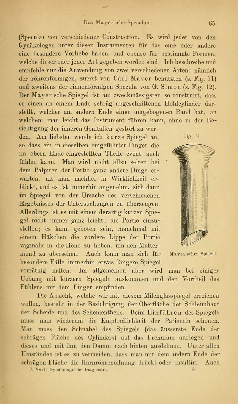 Fiff. 11. (Specula) von verschiedener Construction. Es wird jeder von den Gynäkologen unter diesen Instrumenten für das eine oder andere eine besondere Vorliebe haben, und ebenso für bestimmte Formen, welche dieser oder jener Art gegeben worden sind. Ich beschreibe und empfehle nur die Anwendung von zwei verschiedenen Arten: nämlich der röhrenförmigen, zuerst von Carl Mayer benutzten (s. Fig. 11) und zweitens der rinnenförmigen Specula von Gr. Simon (s. Fig. 12). Der Mayer'sche Spiegel ist am zweckmässigsten so construirt, dass er einen an einem Ende schräg abgeschnittenen Hohlcylinder dar- stellt, welcher am andern Ende einen umgebogenen Rand hat, an welchem man leicht das Instrument führen kann, ohne in der Be- sichtigung der inneren Genitalien gestört zu wer- den. Am liebsten wende ich kurze Spiegel an, so dass ein in dieselben eingeführter Finger die im obern Ende eingestellten Theile event. auch fühlen kann. Man wird nicht allzu selten bei dem Palpiren der Portio ganz andere Dinge er- warten, als man nachher in Wirklichkeit er- blickt, und es ist immerhin angenehm, sich dann im Spiegel von der Ursache des verschiedenen Ergebnisses der Untersuchungen zu überzeugen. Allerdings ist es mit einem derartig kurzen Spie- gel nicht immer ganz leicht, die Portio einzu- stellen; es kann geboten sein, manchmal mit einem Häkchen die vordere Lippe der Portio vaginalis in die Höhe zu heben, um den Mutter- mund zu übersehen. Auch kann man sich für besondere Fälle immerhin etwas längere Spiegel vorräthig halten. Im allgemeinen aber wird man bei einiger üebung mit kürzern Spiegeln auskommen und den Vortheil des Fühlens mit dem Finger empfinden. Die Absicht, welche wir mit diesem Milchglasspiegel erreichen wollen, besteht in der Besichtigung der Oberfläche der Schleimhaut der Scheide und des Scheidentheils. Beim Einführen des Spiegels muss man wiederum die Empfindlichkeit der Patientin schonen. Man muss den Schnabel des Spiegels (das äusserste Ende der schrägen Fläche des Cylinders) auf das Frenulum auflegen und dieses und mit ihm den Damm nach hinten ausdehnen. Unter allen Umständen ist es zu vermeiden, dass man mit dem andern Ende der schrägen Fläche die Harnröhrenöffnung drückt odei- insultirt. Auch ■J. Veit, Gynäkologisf;h<; Diagnostik. 5 Mayer'scher Spiegel.