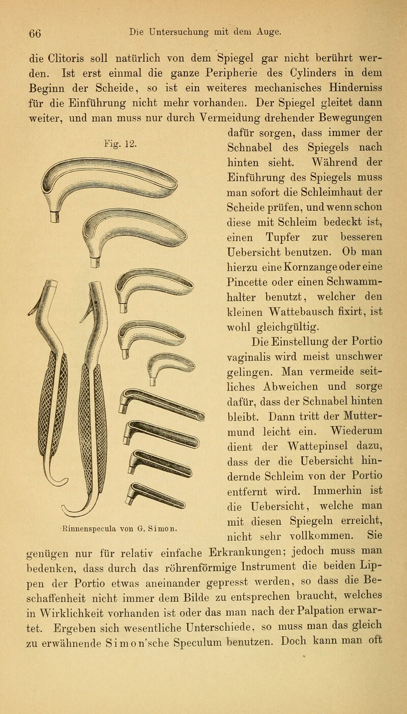 Fig. 12. die Clitoris soll natürlich von dem Spiegel gar nicht berührt wer- den. Ist erst einmal die ganze Peripherie des Cylinders in dem Beginn der Scheide, so ist ein weiteres mechanisches Hinderuiss für die Einführung nicht mehr vorhanden. Der Spiegel gleitet dann weiter, und man muss nur durch Vermeidung drehender Bewegungen dafür sorgen, dass immer der Schnabel des Spiegels nach hinten sieht. Während der Einführung des Spiegels muss man sofort die Schleimhaut der Scheide prüfen, und wenn schon diese mit Schleim bedeckt ist, einen Tupfer zur besseren Uebersicht benutzen. Ob man hierzu eine Kornzange oder eine Pincette oder einen Schwamm- halter benutzt, welcher den kleinen Wattebausch fixirt, ist wohl gleichgültig. Die Einstellung der Portio vaginalis wird meist unschwer gelingen. Man vermeide seit- liches Abweichen und sorge dafür, dass der Schnabel hinten bleibt. Dann tritt der Mutter- mund leicht ein. Wiederum dient der Wattepinsel dazu, dass der die Uebersicht hin- dernde Schleim von der Portio entfernt wird. Immerhin ist die Uebersicht, welche man mit diesen Spiegeln erreicht, nicht sehr vollkommen. Sie Rinnenspeciila von G. Simon. genügen nur für relativ einfache Erkrankungen; jedoch muss man bedenken, dass durch das röhrenförmige Instrument die beiden Lip- pen der Portio etwas aneinander gepresst werden, so dass die Be- schaffenheit nicht immer dem Bilde zu entsprechen braucht, welches in Wirklichkeit vorhanden ist oder das man nach der Palpation erwar- tet. Ergeben sich wesentliche Unterschiede, so muss man das gleich jzu erwähnende Simon'sche Speculum benutzen. Doch kann man oft