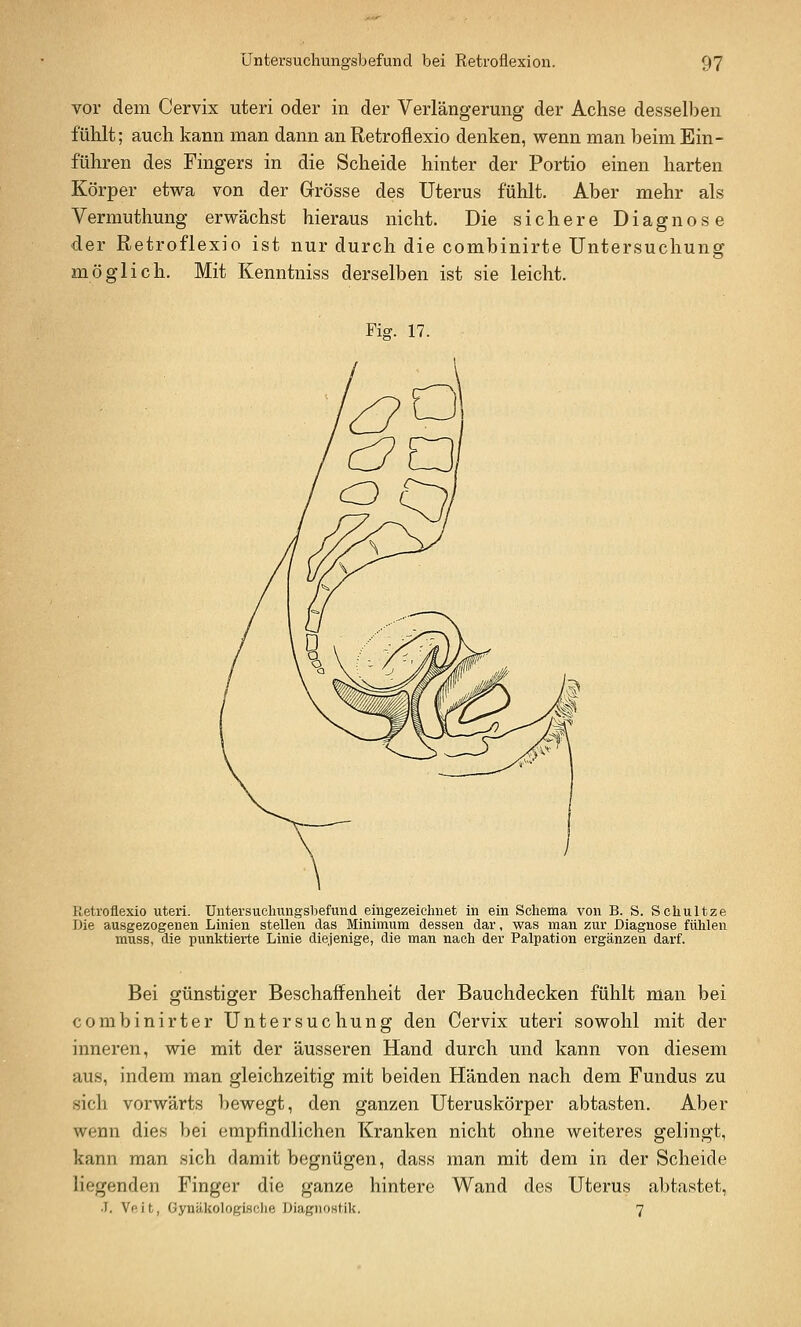vor dem Cervix uteri oder in der Verlängerung der Achse desselben fühlt; auch kann man dann an Retroflexio denken, wenn man heim Ein- führen des Fingers in die Scheide hinter der Portio einen harten Körper etwa von der Grösse des Uterus fühlt. Aber mehr als Vermuthung erwächst hieraus nicht. Die sichere Diagnose der Retroflexio ist nur durch die combinirte Untersuchung möglich. Mit Kenntniss derselben ist sie leicht. Fiff. 17. Retroflexio uteri. Untersuchungsbefund eingezeichnet in ein Schema von B. S. Schultze Die ausgezogenen Linien stellen das Minimum dessen dar, was man zur Diagnose fühlen muss, die punktierte Linie diejenige, die man nach der Palpation ergänzen darf. Bei günstiger Beschaffenheit der Bauchdecken fühlt man bei combinirter Untersuchung den Cervix uteri sowohl mit der inneren, wie mit der äusseren Hand durch und kann von diesem aus, indem man gleichzeitig mit beiden Händen nach dem Fundus zu sich vorwärts bewegt, den ganzen Uteruskörper abtasten. Aber wenn dies bei empfindlichen Kranken nicht ohne weiteres gelingt, kann man sich damit begnügen, dass man mit dem in der Scheide liegenden Finger die ganze hintere Wand des Uterus abtastet, .1. Vftit, üynäkologisclie Diagnostik. 7