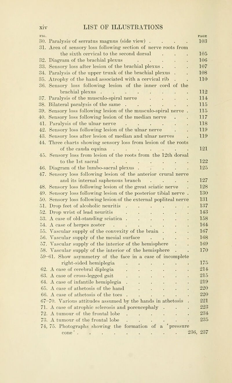 FIG. PAGE 30. Paralysis of serratus magnus (side view) .... 103 31. Area of sensory loss following section of nerve roots from the sixth cervical to the second dorsal . . . 105 32. Diagram of the brachial plexus 106 33. Sensory loss after lesion of the brachial plexus . . . 107 34. Paralysis of the upper trunk of the brachial plexus . . 108 35. Atrophy of the hand associated with a cervical rib . . 110 36. Sensory loss following lesion of the inner cord of the brachial plexus . . . . . . . . 112 37. Paralysis of the musculo-spiral nerve .... 114* 38. Bilateral paralysis of the same . . . . . . 115 39. Sensory loss following lesion of the musculo-spiral nerve . 115 40. Sensory loss following lesion of the median nerve . . 117 41. Paralysis of the ulnar nerve . . . . . . 118 42. Sensory loss following lesion of the ulnar nerve . . 119 43. Sensory loss after lesion of median and ulnar nerves . 119 44. Three charts showing sensory loss from lesion of the roots of the cauda equina . . . . . . . 121 45. Sensory loss from lesion of the roots from the 12th dorsal to the 1st sacral ....... 122 46. Diagram of the lumbo-sacral plexus ..... 125 47. Sensory loss following lesion of the anterior crural nerve and its internal saphenous branch . . . . 127 48. Sensory loss following lesion of the great sciatic nerve . 128 49. Sensory loss following lesion of the posterior tibial nerve . 130 50. Sensory loss following lesion of the external popliteal nerve 131 51. Drop feet of alcoholic neuritis . . . . . . 137 52. Drop wrist of lead neuritis ...... 143 53. A case of old-standing sciatica . . . . . . 158 54. A case of herpes zoster . . . . . . . 164 55. Vascular supply of the convexity of the brain . . . 167 56. Vascular supply of the mesial surface , 168 57. Vascular supply of the interior of the hemisphere . . 169 58. Vascular supply of the interior of the hemisphere . . 170 59-61. Show asymmetry of the face in a case of incomplete right-sided hemiplegia ...... 175 62. A case of cerebral diplegia ...... 214 63. A case of cross-legged gait . . . . . . 215 64. A case of infantile hemiplegia ...... 219 65. A case of athetosis of the hand ..... 220 66. A case of athetosis of the toes ...... 220 67-70. Various attitudes assumed by the hands in athetosis . 221 71. A case of atrophic sclerosis and porencephaly . . . 223 72. A tumour of the frontal lobe ...... 234 73. A tumour of the frontal lobe ...... 235 74. 75. Photographs showing the formation of a ' pressure cone' 236, 237