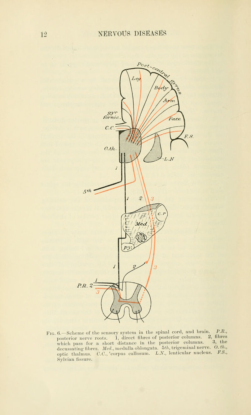 /w, F.S. P.R.Z Fig. 6.—Scheme of the sensory system in the spinal cord, and brain. P.R., posterior nerve roots. 1, direct fibres of posterior columns. 2, fibres which pass for a short distance in the posterior columns. 3, the decussating fibres. Med., medulla oblongata. 5th, trigeminal nerve. 0. th., optic thalmus. C.C., 'corpus callosum. L.N., lenticular nucleus. F.S., Sylvian fissure.