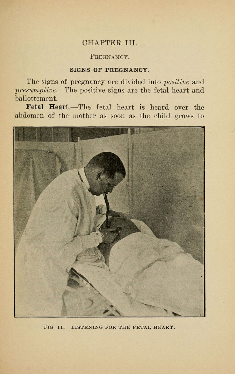 CHAPTER III. Pregnancy. SIGNS OF PREGNANCY. The signs of pregnancy are divided into positive and presumptive. The positive signs are the fetal heart and ballottement. Fetal Heart.—The fetal heart is heard over the abdomen of the mother as soon as the child grows to FIG II. LISTENING FOR THE FETAI, HEART.