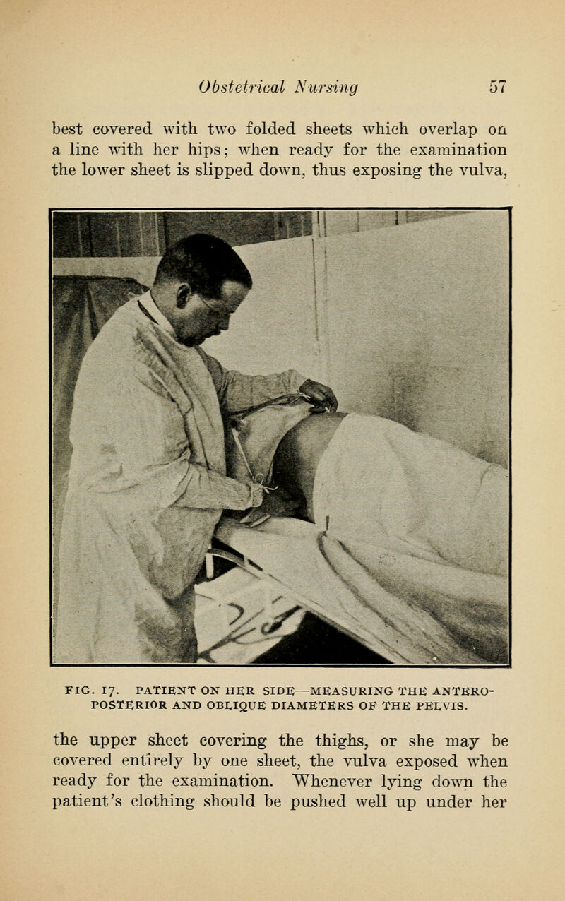 best covered with two folded sheets which overlap on a line with her hips; when ready for the examination the lower sheet is slipped down, thus exposing the vulva, FIG. 17. PATIENT ON HER SIDE—MEASURING THE ANTERO- POSTERIOR AND OBLIQUE DIAMETERS OF THE PEIVIS. the upper sheet covering the thighs, or she may be covered entirely by one sheet, the vulva exposed when ready for the examination. Whenever lying down the patient's clothing should be pushed well up under her