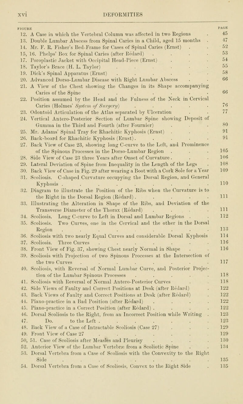 FIGURE 12. A Case in which the Vertebral Column was affected in two Regions 13. Double Lumbar Abscess from Spinal Caries in a Child, aged 15 months 14. Mr. F. R. Fisher's Bed-Frame for Cases of Spinal Caries (Ernst) 1.5, 16. Phelps' Box for Spinal Caries (after Kedard) 17. Poroplastic Jacket with Occipital Head-Piece (Ernst) 18. Taylor's Brace (H. L. Taylor) ..... 19. Dick's Spinal Apparatus (Ernst) ..... 20. Advanced Dorso-Lumbar Disease with Right Lumbar Abscess 21. A View of the Che.st showing the Changes in its Shape accompanying Caries of the Spine ...... 22. Po.sition assumed by the Head and the Fulness of the Neck in Cervical Caries {Holmes System of Surc/erij) .... 2-3. Odontoid Articulation of the Atlas separated by Ulceration 24. Vertical Antero-Posterior Section of Lumbar Spine showing Deposit of Gumma in the Third and Fourth (after Fournier) 25. Mr. Adams' Spinal Tray for Rhachitic Kyphosis (Ernst) 26. Back-board for Rhachitic Kyphosis (Ernst). 27. Back View of Case 23, showing long C-curve to the Left, and Prominence of the Spinous Processes in the Dorso-Lumbar Region 28. Side View of Case 23 three Years after Onset of Curvature . 29. Lateral Deviation of Spine from Inequality in the Length of the Legs 30. Back View of Case in Fig. 29 after wearing a Boot with a Cork Sole for a Year 31. Scoliosis. C-shaped Curvature occupying the Dorsal Region, and General Kyphosis ........ 32. Diagram to illustrate the Position of the Ribs when tlie Curvature is to the Right in the Dorsal Region (Redard).... 33. Illustrating the Alteration in Shape of the Ribs, and Deviation of the Transverse Diameter of the Thorax (Redard) 34. Scoliosis. Long C-curve to Left in Dorsal and Lumbar Regions . 35. Scoliosis. Two Curve.s, one in the Cervical and the other in the Dorsal Region ........ 36. Scoliosis with two nearly Equal Curves and considerable Dorsal Kyphosis 37. Scoliosis. Three Curves ...... 38. Front View of Fig. 37, showing Chest nearly Normal in Shape 39. Scoliosis with Projection of two Spinous Processes at the Intersection of the two Curves ....... 40. Scoliosis, with Reversal of Normal Lumbar Curve, and Posterior Projec- tion of the Lumbar Spinous Processes .... 41. Scoliosis with Reversal of Normal Antero-Posterior Curves 42. Side Views of Faulty and Correct Positions at Desk (after Redard) 43. Back Views of Faulty and Correct Positions at Desk (after Redard) 44. Piano-practice in a Bad Position (after Redard) 45. Piano-^jractice in a Correct Position (after Redard) . 46. Dorsal Scoliosis to the Right, from an Incorrect Position while Writing 47. Do. to the Left ...... 48. Back View of a Case of Intractable Scoliosis (Case 27) 49. Front View of Case 27 ..... . 50. 51. Case of Scoliosis after Measles and Pleurisy 52. Anterior View of the Lumbar Vertebrre from a Scoliotic Spine 53. Dorsal Vertebra from a Case of Scoliosis with the Convexity to the Right Side . . 54. Dorsal Vertebra from a Case of Scoliosis, Convex to the Right Side