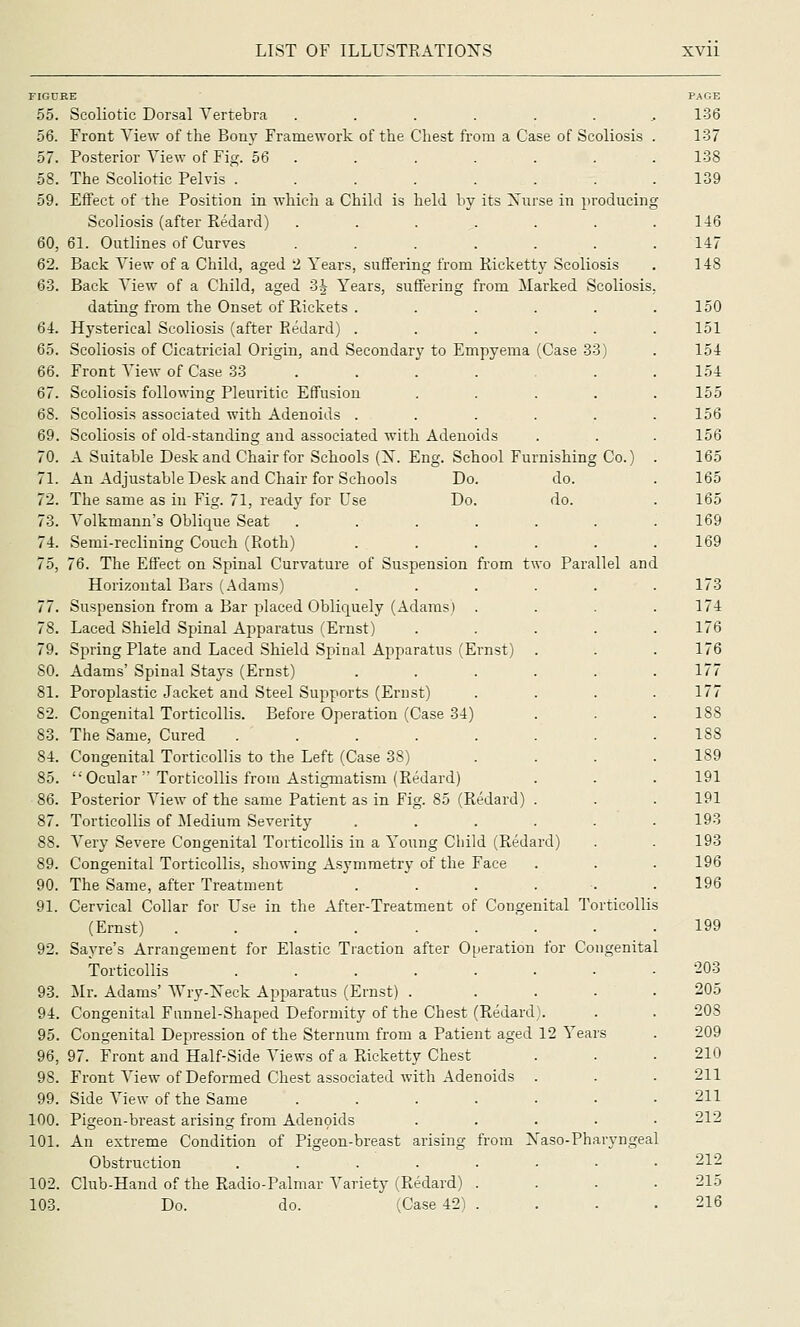 from two Parallel and riGUKE 55. Scoliotic Dorsal Vertebra ...... 56. Front Aie\v of the Bony Framework of the Chest from a Case of Scoliosis 57. Posterior View of Fig. 56 . 58. The Scoliotic Pelvis ....... 59. Effect of the Position in which a Child is held by its Xnrse in })roducin Scoliosis (after Redard) ....... 60. 61. Outlines of Curves ...... 62. Back View of a Child, aged '2 Years, suffering from Ricketty Scoliosis 63. Back View of a Child, aged .3^ Years, suffering from Marked Scoliosis dating from the Onset of Rickets ..... 64. Hysterical Scoliosis (after Redard) ..... 65. Scoliosis of Cicatricial Origin, and Secondary to Empyema (Case 83) 66. Front View of Case 33 ..... . 67. Scoliosis following Pleuritic Effusion .... 68. Scoliosis associated with Adenoids ..... 69. Scoliosis of old-standing and associated with Adenoids 70. A Suitable Desk and Chair for Schools (N. Eng. School Furnishing Co.) 71. An Adjustable Desk and Chair for Schools Do. do. 72. The same as in Fig. 71, ready for Use Do. do. 73. Volkmann's Oblique Seat 74r. Semi-reclining Couch (Roth) 75, 76. The Effect on Spinal Curvature of Suspension Horizontal Bars (Adams) 77. Suspension from a Bar placed Obliquely (Adams) 78. Laced Shield Spinal Apparatus (Ernst) 79. Spring Plate and Laced Shield Spinal Apparatus (Ernst) SO. Adams' Spinal Stays (Ernst) 81. Poroplastic Jacket and Steel Supports (Ernst) 82. Congenital Torticollis. Before Operation (Case 34) 83. The Same, Cured .... 84. Congenital Torticollis to the Left (Case 38) 85. Ocular  Torticollis from Astigmatism (Redard) 86. Posterior View of the same Patient as in Fig. 85 (Redard) . 87. Torticollis of iledium Severity ..... Very Severe Congenital Torticollis in a Young Child (Redard) Congenital Torticollis, showing Asymmetry of the Face The Same, after Treatment 91. Cervical Collar for Use in the After-Treatment of Congenital Torticolli (Ernst) ........ Sayre's Arrangement for Elastic Traction after Operation for Congenital Torticollis . . . . . . Mr. Adams' Wr3'^-Xeck Apparatus (Ernst) .... Congenital Funnel-Shaped Deformity of the Chest (Redard). Congenital Depression of the Sternum from a Patient aged 12 Years 97. Front and Half-Side Views of a Ricketty Chest Front View of Deformed Chest associated with Adenoids . Side View of the Same Pigeon-breast arising from Adenoids An extreme Condition of Pigeon-breast arising from Xaso-Pharyngeal Obstruction 102. Club-Hand of the Radio-Palmar Variety (Redard) 103. Do. do. (Case 42) 88 90 92. 93. 94. 95. 96, 98. 99. 100. 101.