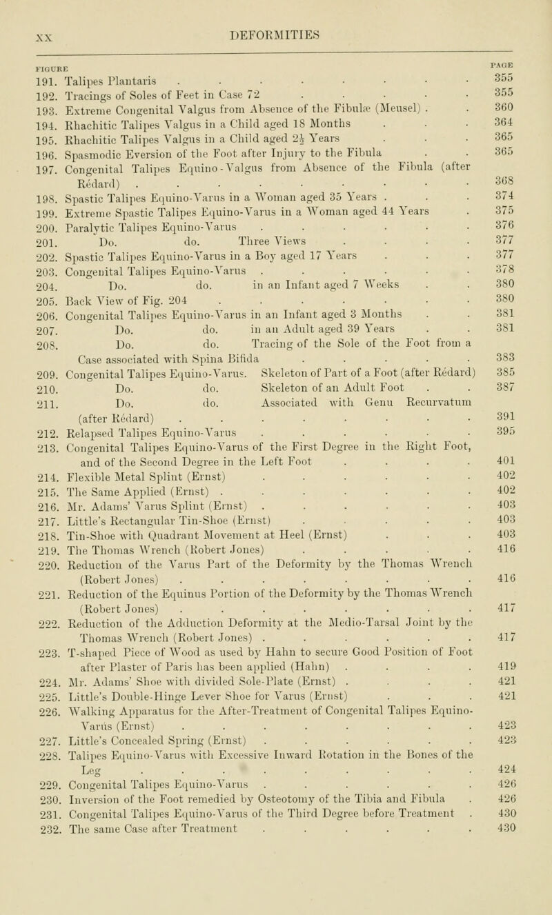 riOURE 191. Talipes riaiitaris ....•■ 192. Tracings of Soles of Feet in Case 72 ... 193. Extreme Congenital Valgus from Absence of the Fibube (Meusel) 194. Rhachitic Talipes Valgus in a Child aged 18 Months 195. Rhachitic Talipes Valgus in a Child aged 2i Years 196. Spasmodic Eversion of the Foot after Injury to the Fibula 197. Congenital Talipes Equino-Valgus from Absence of the Fibula (after Redard) ......-• 198. Spastic Talipes Equino-Varus in a Woman aged 35 Years . 199. Extreme Spastic Talipes Ilquino-Varus in a AVoman aged 44 Years 200. Paralytic Talipes Equino-Varus ..... 201. Do. do. Three Views 202. Spastic Talipes Equino-Varus in a Boy aged 17 Years 203. Congenital Talipes Equino-A'arus ..... 204. Do. do. in an Infant aged 7 Weeks 205. Back View of Fig. 204 ..... • 206. Congenital Talipes Equino-Varus in an Infant aged 3 Months 207. Do. do. in an Adult aged 39 Years 208. Do. do. Tracing of the Sole of the Foot from Case associated with Spina Bifida .... Congenital Talipes E(iuino-Varus. Skeleton of Part of a Foot (after Redard) 209 210 211 Skeleton of an Adult Foot Associated with Genu Recurvatum Do. do. Do. do. (after Reilard) ....... 212. Relapsed Talipes Equino-Varus ..... 213. Congenital Talipes Equino-Varus of the First Degree in tlie Right Foot and of the Second Degree in the Left Foot 214. Flexible Metal Splint (Ernst) ..... 215. The Same Applied (Ernst) ...... 216. Mr. Adams' Amarus Splint (Ernst) ..... 217. Little's Rectangular Tin-Shoe (Ernst) .... 218. Tin-Shoe with Quadrant Movement at Heel (Ernst) 219. The Thomas Wrench (Robert Jones) .... 220. Reduction of the Amarus Part of the Deformity l)y the Thomas AA^renc (Robert Jones) ....... 221. Reduction of the Equinus Portion of the Deformity by the Thomas AVrench (Robert Jones) ....... 222. Reduction of the Adduction Deformity at the Medio-Tarsal Joint by th Thomas AVrench (Robert Jones) ..... 223. T-shaped Piece of AVood as used by Hahu to secure Good Position of Foot after Plaster of Paris has been applied (Halin) 224. Mr. Adams' Shoe with divided Sole-Plate (Ernst 225. Little's Double-Hinge Lever Shoe for A'arus (Ernst) 226. AValking Apparatus for the After-Treatment of Congenital Talipes Equino Amarus (Ernst) ....... 227. Little's Concealed Spring (Ernst) ..... 228. Talipes Equino-A'arus witli Excessive Inward Rotation in the Bones of th Leg ....... ■ 229. Congenital Talipes Equino-A'arus ..... 230. Inversion of the Foot remedied by Osteotomy of the Tibia and Fibula 231. Congenital Talipes Equino-A^arus of the Third Degree before Treatment 232. The same Case after Treatment .....