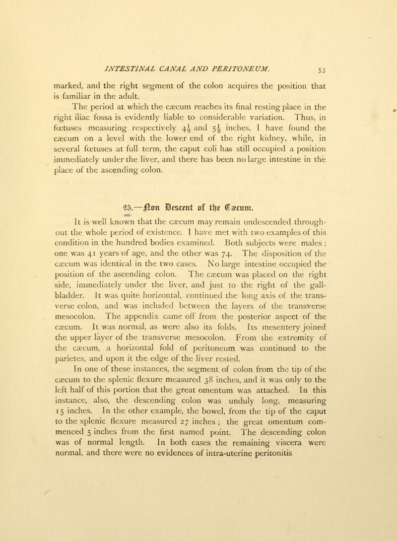 marked, and the right segment of the colon acquires the position that is familiar in the adult. The period at which the caecum reaches its final resting place in the right iliac fossa is evidently liable to considerable variation. Thus, in foetuses measuring respectively \\ and 5^ inches, I have found the Ccecum on a level with the lower end of the right kidney, while, in several foetuses at full term, the caput coli has still occupied a position immediately under the liver, and there has been no large intestine in the place of the ascending colon. 23.—|Jon )ifa«nt of tljc Carum. It is well known that the caecum may remain undescended through- out the whole period of existence. I have met with two examples of this condition in the hundred bodies examined. Both subjects were males ; one was 41 years of age, and the other was 74. The disposition of the caicum was identical in the two cases. No large intestine occupied the position of the ascending colon. The caecum was placed on the right side, immediately under the liver, and just to the right of the gall- bladder. It was quite horizontal, continued the long axis of the trans- verse colon, and was included between the layers of the transverse mesocolon. The appendix came off from the posterior aspect of the caecum. It was normal, as were also its folds. Its mesentery joined the upper layer of the transverse mesocolon. From the extremity of the caecum, a horizontal fold of peritoneum was continued to the parietes, and upon it the edge of the liver rested. In one of these instances, the segment of colon from the tip of the caecum to the splenic flexure measured 38 inches, and it was only to the left half of this portion that the great omentum was attached. In this instance, also, the descending colon was unduly long, measuring 15 inches. In the other example, the bowel, from the tip of the caput to the splenic flexure measured 27 inches ; the great omentum com- menced 5 inches from the first named point. The descending colon was of normal length. In both cases the remaining viscera were normal, and there were no evidences of intra-uterine peritonitis