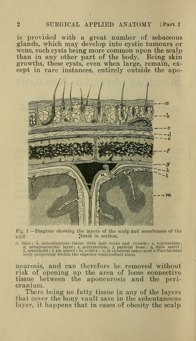 is provided with a great number of sebaceous glands, which may develop into cystic tumours or wens, such cysts being more common upon the scalp than in any other part of the body. Being skin growths, these cysts, even when large, remain, ex- cept in rare instances, entirely outside the apo- Fig. 1 —Diagram showing the layers of the scalp and membranes of the R VJ; *brain in section. a, Skin; U, subcutaneous tissue with bail' roots and vessels; c, epicranium; ii, subaponeurotic layer; e, pericranium; /, parietal bone; g, dura mater; /.-, arachnoid ; I, pia mater; m, cortex ; n, in subdural space near a Pacchionian body projecting within the superior Longitudinal sinus. neurosis, and can therefore be removed without risk of opening up the area of loose connective tissue between the aponeurosis and the peri- cranium. There being no fatty tissue in any of the layers that cover the bony vault save in the subcutaneous layer, it happens that in cases of obesity the scalp