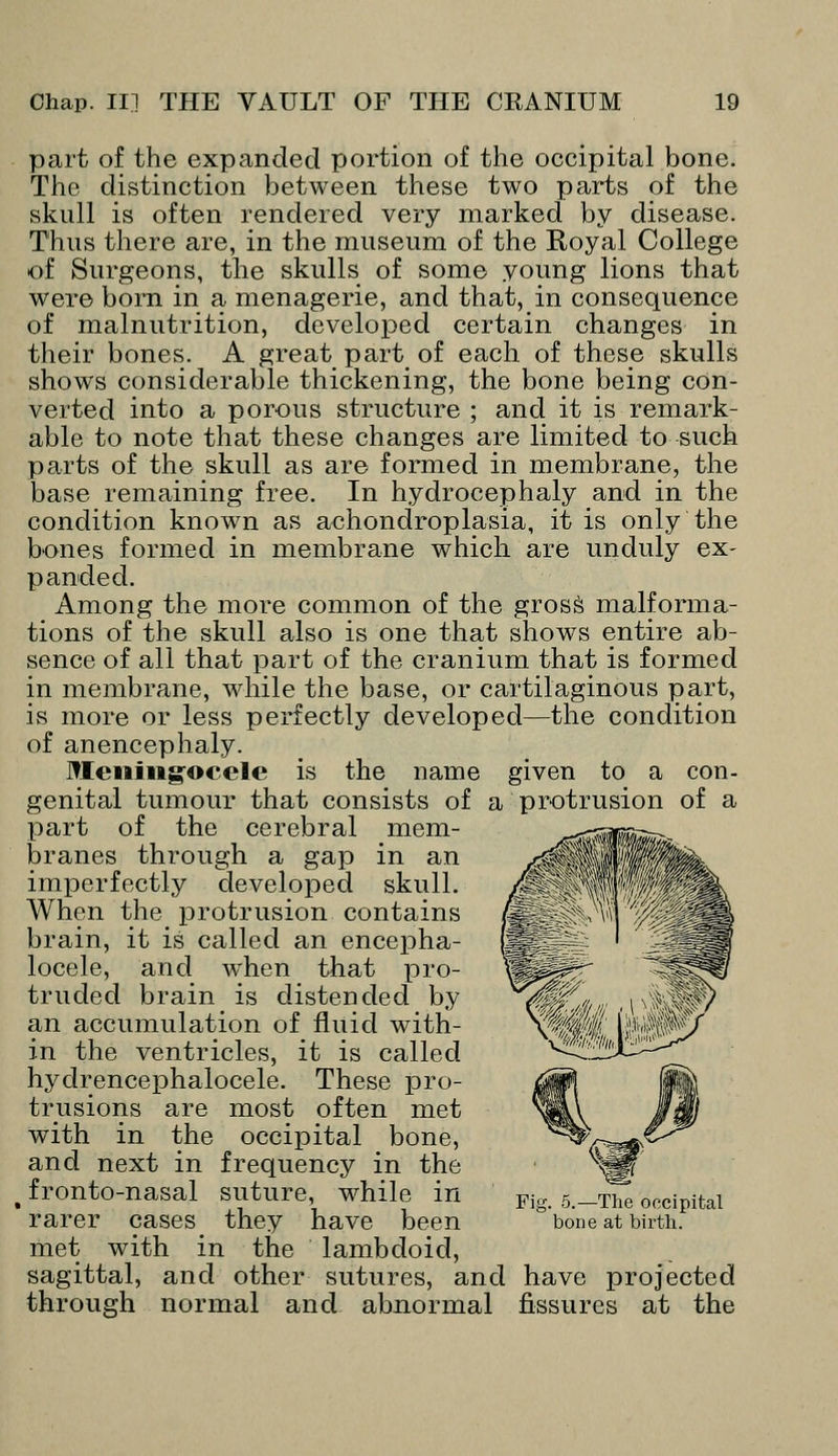 part of the expanded portion of the occipital bone. The distinction between these two parts of the skull is often rendered very marked by disease. Thus there are, in the museum of the Royal College of Surgeons, the skulls of some young lions that were born in a menagerie, and that, in consequence of malnutrition, developed certain changes in their bones. A great part_ of each of these skulls shows considerable thickening, the bone being con- verted into a porous structure ; and it is remark- able to note that these changes are limited to such parts of the skull as are formed in membrane, the base remaining free. In hydrocephaly and in the condition known as achondroplasia, it is only the bones formed in membrane which are unduly ex- panded. Among the more common of the gross malforma- tions of the skull also is one that shows entire ab- sence of all that part of the cranium that is formed in membrane, while the base, or cartilaginous part, is more or less perfectly developed—the condition of anencephaly. Meningocele is the name given to a con- genital tumour that consists of a protrusion of a part of the cerebral mem- branes through a gap in an imperfectly developed skull. When the protrusion contains brain, it is called an encepha- locele, and wrhen that pro- truded brain is distended by an accumulation of fluid with- in the ventricles, it is called hydrencephalocele. These pro- trusions are most often met with in the occipital bone, and next in frequency in the fronto-nasal suture, while in rarer cases they have been met with in the lambdoid, sagittal, and other sutures, and have projected through normal and abnormal fissures at the Fig. 5.—The occipital bone at birth.