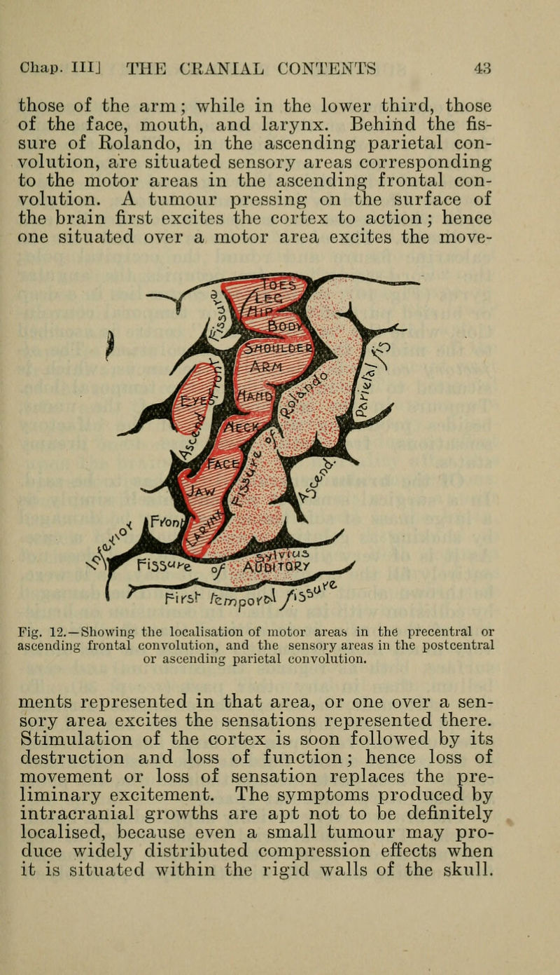 those of the arm; while in the lower third, those of the face, mouth, and larynx. Behind the fis- sure of Rolando, in the ascending parietal con- volution, are situated sensory areas corresponding to the motor areas in the ascending frontal con- volution. A tumour pressing on the surface of the brain first excites the cortex to action; hence one situated over a motor area excites the move- Pirsf IzrnpoY^/^ Fig. 12.—Showing the localisation of motor areas in the precentral or ascending frontal convolution, and the sensory areas in the postcentral or ascending parietal convolution. ments represented in that area, or one over a sen- sory area excites the sensations represented there. Stimulation of the cortex is soon followed by its destruction and loss of function; hence loss of movement or loss of sensation replaces the pre- liminary excitement. The symptoms produced by intracranial growths are apt not to be definitely localised, because even a small tumour may pro- duce widely distributed compression effects when it is situated within the rigid walls of the skull.