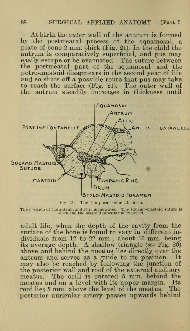 At birth the outer wall of the antrum is formed by the postmeatal process of the squamosal, a plate of bone 2 mm. thick (Fig. 21). In the child the antrum is comparatively superficial, and pus may easily escape or be evacuated. The suture between the postmeatal part of the squamosal and the petro-mastoid disappears in the second year of life and so shuts off a possible route that pus may take to reach the surface (Fig. 21). The outer wall of the antrum steadily increases in thickness until Squamosal Antrum Attic Post.I/nf. Fontanelle A/it Imp. Fo^tamelle Squamo/Iastoi 5UTURE /iASToiD/ T'TyAiPA/HicRinc; Drum stylomastoid forame/h Fig. 21.—The temporal bone at birth. The position of the antrum and attic is indicated. The squamo-niastoid suture is open and the mastoid process undeveloped. adult life, when the depth of the cavity from the surface of the bone is found to vary in different in- dividuals from 12 to 22 mm., about 16 mm. being its average depth. A shallow triangle {see Fig. 20) above and behind the meatus lies directly over the antrum and serves as a guide to its position. It may also be reached by following the junction of the posterior wall and roof of the external auditory meatus. The drill is entered 5 mm. behind the meatus and on a level with its upper margin. Its roof lies 5 mm. above the level of the meatus. The posterior auricular artery passes upwards behind