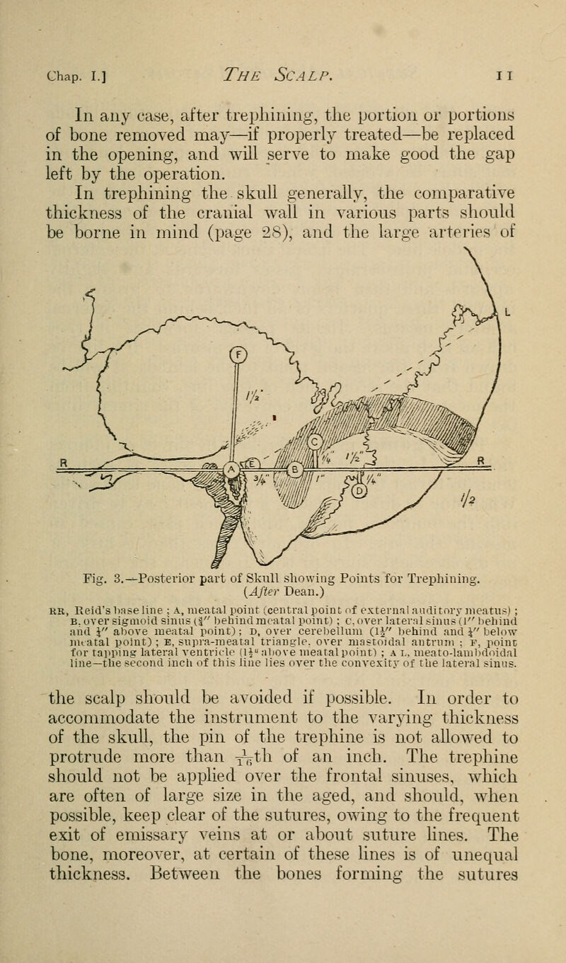 In any ease, after trephining, the portion or portions of bone removed may—if properly treated—be replaced in the opening, and will serve to make good the gap left by the operation. In trephining the skull generally, the comparative thickness of the cranial wall in various parts should be borne in mind (page 28), and the large arteries of Fig. 3.—Posterior part of Skull showing Points for Trephining. {After Dean.) rr, Reid's base line ; a, mental point (central point of external auditory meatus); b. over sigmoid smus(| behind mental point); c, over lateral sinus (1 behind and \ above mental point); d, over cerebellum (lj behind and J below nuatal point); B, supra-meatal triangle, over mastoidal antrum ; f, point for tapping lateral ventricle diabove nieatalpoint) ; a l, meato-lambdoidal line—the second inch of this line lies over the convexity of the lateral sinus. the scalp should be avoided if possible. In order to accommodate the instrument to the varying thickness of the skull, the pin of the trephine is not allowed to protrude more than t^th of an inch. The trephine should not be applied over the frontal sinuses, which are often of large size in the aged, and should, when possible, keep clear of the sutures, owing to the frequent exit of emissary veins at or about suture lines. The bone, moreover, at certain of these lines is of unequal thickness. Between the bones forming the sutures