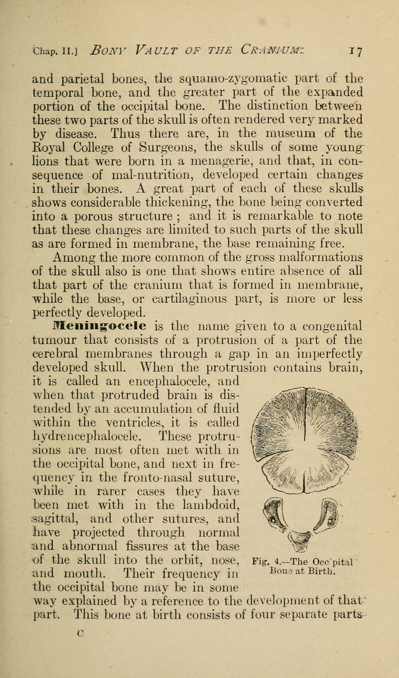 and parietal bones, the squamo-zygomatie part of the temporal bone, and the greater part of the expanded portion of the occipital bone. The distinction between these two parts of the skull is often rendered very marked by disease. Thus there are, in the museum of the Royal College of Surgeons, the skulls of some young- lions that were born in a menagerie, and that, in con- sequence of mal-nutrition, developed certain changes in their bones. A great part of each of these skulls shows considerable thickening, the bone being converted into a porous structure ; and it is remarkable to note that these changes are limited to such parts of the skull as are formed in membrane, the base remaining free. Among the more common of the gross malformations of the skull also is one that shows entire absence of all that part of the cranium that is formed in membrane, while the base, or cartilaginous part, is more or less perfectly developed. Meningocele is the name given to a congenital tumour that consists of a protrusion of a part of the cerebral membranes through a gap in an imperfectly developed skull. When the protrusion contains brain, it is called an encephalocele, and when that protruded brain is dis- tended by an accumulation of fluid within the ventricles, it is called hydrencephalocele. These protru- sions are most often met with in the occipital bone, and next in fre- quency in the fronto-nasal suture, while in rarer cases they have been met with in the lambdoid, sagittal, and other sutures, and have projected through normal and abnormal fissures at the base •of the skull into the orbit, nose, and mouth. Their frequency in the occipital bone may be in some way explained by a reference to the development of that part. This bone at birth consists of four separate parts Fig. 4.—The Occpital Bona at Birth.