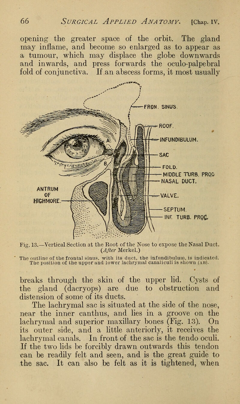 opening the greater space of the orbit. The gland may inflame, and become so enlarged as to appear as a tumour, which may displace the globe downwards and inwards, and press forwards the oculo-palpebral fold of conjunctiva. If an abscess forms, it most usually fron. SINUS. ROOF, INFUNDIBULUM. SAC FOLD. MIDDLE TURB. PROG NASAL DUCT. =-VALVE. SEPTUM. INF. TURB. PRO& Fig. 13.—Vertical Section at the Root of the Nose to expose the Nasal Duct. {After Merkel.) The outline of the frontal sinus, with its duct, the infundibuluni, is indicated. Tlie position of the upper and lower lachrymal canaliculi is shown (ab). breaks through the skin of the upper lid. Cysts of the gland (dacryops) are due to obstruction and distension of some of its ducts. The lachrymal sac is situated at the side of the nose, near the inner canthus, and lies in a groove on the lachrymal and superior maxillary bones (Fig. 13). On its outer side, and a little anteriorly, it receives the lachrymal canals. In front of the sac is the tendo oculi. If the two lids be forcibly drawn outwards this tendon can be readily felt and seen, and is the great guide to the sac. It can also be felt as it is tightened, when