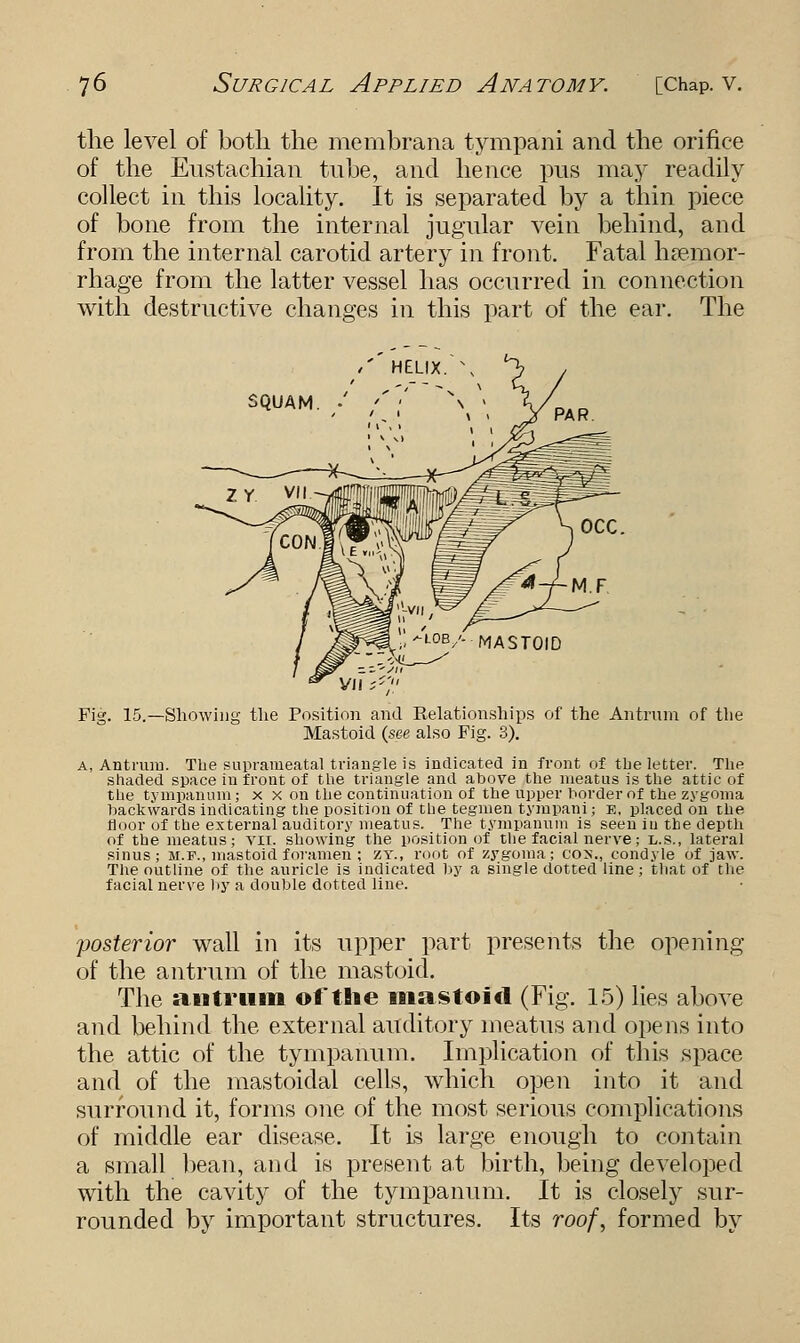 the level of both the membrana tympani and the orifice of the Eustachian tube, and hence pus may readily collect in this locality. It is separated by a thin piece of bone from the internal jugular vein behind, and from the internal carotid artery in front. Fatal hsepaor- rhage from the latter vessel has occurred in connection with destructive changes in this part of the ear. The /' HELIX. \ SQUAM. •' Fig. 15.—Showing the Position and Relationships of the Antrum of the Mastoid (see also Fig. 3). a, Antrum. The suprameatal triangle is indicated in front of the letter. The shaded space in front of the triangle and above the meatus is the attic of the tympanum ; x x on the continuation of the upper border of the zygoma backwards indicating the position of the tegmen tympani; e, placed on the floor of the external auditory meatus. The tympanum is seen in the depth of the meatus; vn. showing the position of the facial nerve; l.s., lateral sinus; m.f., mastoid foramen; zy., root of zygoma; co>\, condyle of jaw. The outline of the auricle is indicated by a single dotted line; that of the facial nerve by a double dotted line. posterior wall in its upper part presents the opening of the antrum of the mastoid. The antrum of the mastoid (Fig. 15) lies above and behind the external auditory meatus and opens into the attic of the tympanum. Implication of this space and of the mastoidal cells, which open into it and surround it, forms one of the most serious complications of middle ear disease. It is large enough to contain a small bean, and is present at birth, being developed with the cavity of the tympanum. It is closely sur- rounded by important structures. Its roof, formed by