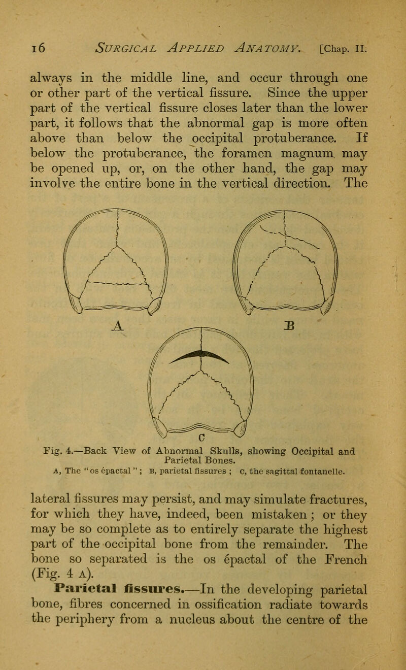 occur through one always in the middle line, and or other part of the vertical fissure. Since the upper part of the vertical fissure closes later than the lower part, it follows that the abnormal gap is more often above than below the occipital protuberance. If below the protuberance, the foramen magnum, may be opened up, or, on the other hand, the gap may involve the entire bone in the vertical direction. The rig. 4.—Back View of Abnormal Skulls, showing Occipital and Parietal Bones. A, The OS epactal  ; B, parietal fissures ; c, the sagittal fontanelle. lateral fissures may persist, and may simulate fractures, for which they have, indeed, been mistaken; or they may be so complete as to entirely separate the highest part of the occipital bone from the remainder. The bone so separated is the os epactal of the French (Fig. 4 A). Parietal fissui'es.—In the developing parietal bone, fibres concerned in ossification radiate towards the periphery from a nucleus about the centre of the