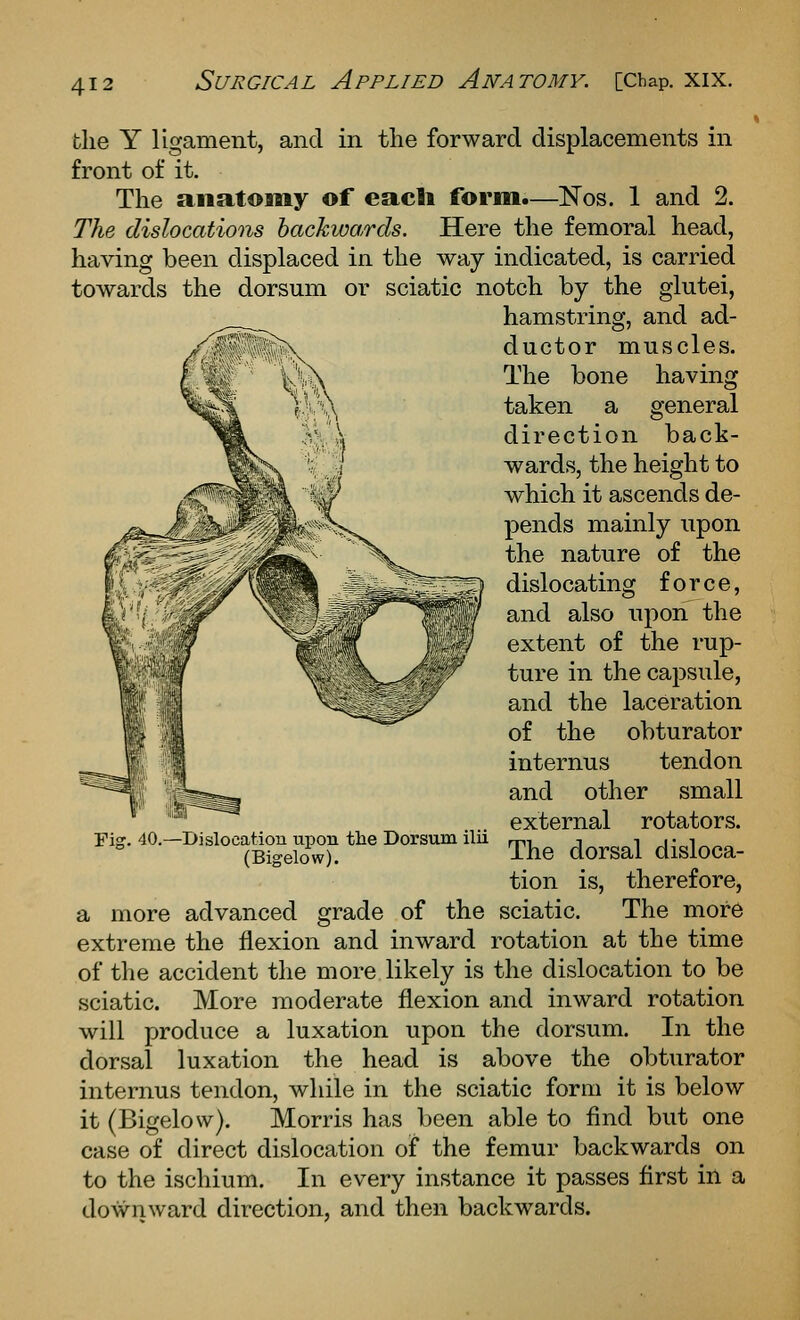 having general the Y ligament, and in the forward displacements in front of it. The anatomy of eacli form.—Nos. 1 and 2. The, dislocations backwards. Here the femoral head, having been displaced in the way indicated, is carried towards the dorsum or sciatic notch by the glutei, hamstring, and ad- ductor muscles. The bone taken a direction back- wards, the height to which it ascends de- pends mainly upon the nature of the dislocating force, and also uj^on the extent of the rup- ture in the caj^sule, and the laceration of the obturator internus tendon and other small external rotators. The dorsal disloca- tion is, therefore, a more advanced grade of the sciatic. The more extreme the flexion and inward rotation at the time of tlie accident the more likely is the dislocation to be sciatic. More moderate flexion and inward rotation will produce a luxation upon the dorsum. In the dorsal luxation the head is above the obturator internus tendon, while in the sciatic form it is below it (Bigelow). Morris has been able to find but one case of direct dislocation of the femur backwards on to the ischium. In every instance it passes first in a downward direction, and then backwards. Fig, 40.—Dislocation npon the Dorsum ilii (Bigelow).