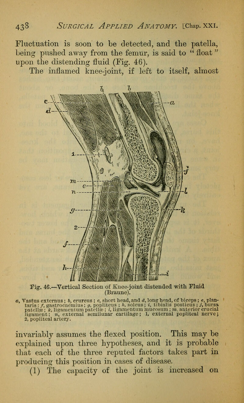 Fluctuation is soon to be detected, and tlie patella, being pushed away from tlie femur, is said to  float  upon the distending fluid (Fig. 46). The inflamed knee-joint, if left to itself, almost Fig. 46.~Vertical Section of Knee-joint distended with Fluid (Braune). o. Vastus extemns; 6, crureus ; c, short head, and d, lon^ head, of biceps; e, plan- taris: f, gastrocnemius; g, popliteus ; h, soleus; i, tibialis posticus ; ^'j bursa patellae ; k, ligamentum patella;; I, ligamentiiui mucosum ; m. anterior crucial ligament; w, external semilunar cartilage; 1, external popliteal nerve; 2, popliteal artery. invariably assumes the flexed position. This may be explained upon three hypotheses, and it is probable tliat each of the three rej)uted factors takes part in producing: this position in cases of disease. (1) The capacity of the joint is increased on