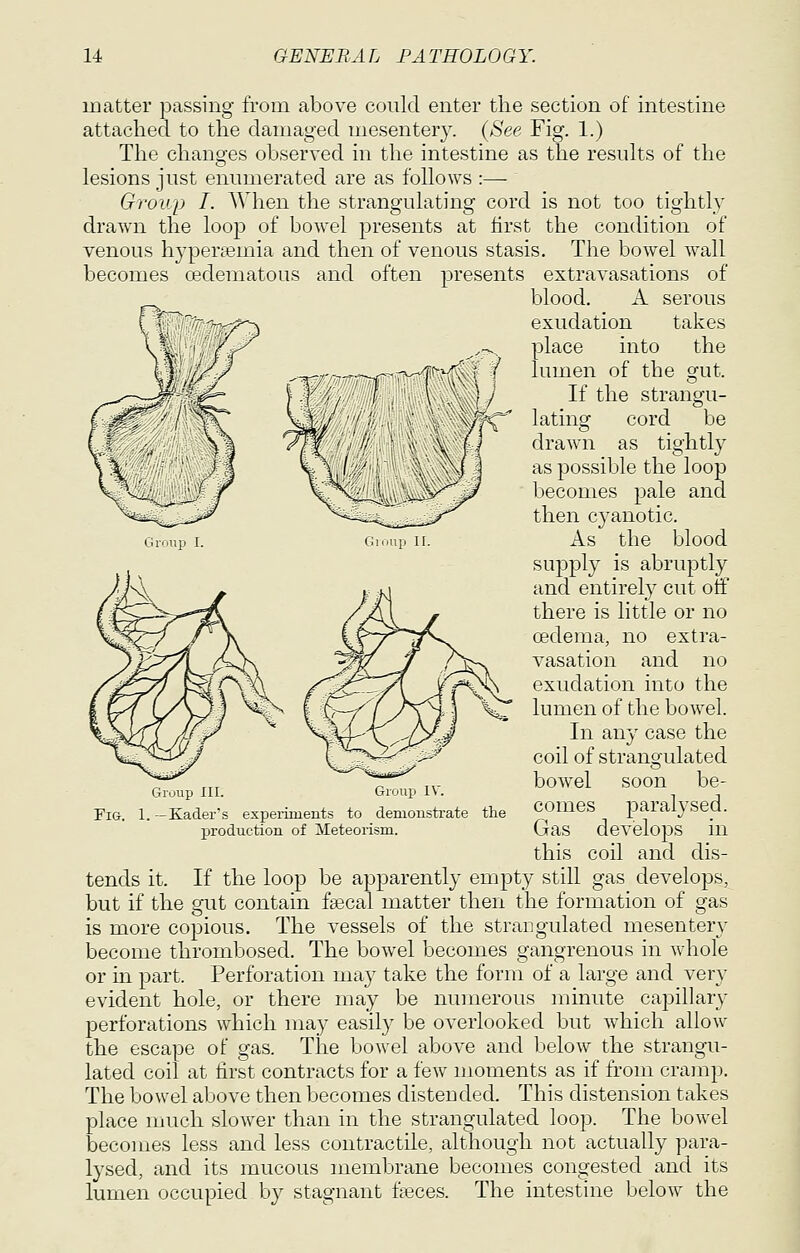 matter passing from above could enter the section of intestine attached to the damaged mesentery. {See Fig. 1.) The changes observed in the intestine as the resuks of the lesions just enumerated are as follows :— Group I. AVhen the strangulating cord is not too tightly drawn the loop of bowel presents at first the condition of venous hj^persemia and then of venous stasis. The bowel wall becomes oedematous and often presents extravasations of blood. A serous exudation takes place into the lumen of the gut. If the strangu- lating cord be drawn as tightly as possible the loop becomes pale and then cyanotic. As the blood supply is abruptly and entirely cut otf there is little or no oedema, no extra- vasation and no exudation into the lumen of the bowel. In any case the coil of strangulated bowel soon be- comes paralysed. Gas develops in this coil and dis- tends it. If the loop be apparently empty still gas develops, but if the gut contain fsecal matter then the formation of gas is more copious. The vessels of the strangulated mesentery become thrombosed. The bowel becomes gangrenous in whole or in part. Perforation may take the form of a large and very evident hole, or there may be numerous minute capillary perforations which may easily be overlooked but which allow the escape of gas. The bowel above and below the strangu- lated coil at first contracts for a few moments as if from crainp. The bowel above then becomes distended. This distension takes place much slower than in the strangulated loop. The bowel becomes less and less contractile, although not actually para- lysed, and its mucous membrane becomes congested and its lumen occupied by stagnant fieces. The intestine below the Fig. Group III. Group IV. 1. — Kader's experiments to demonsti-ate the production of Meteorism.