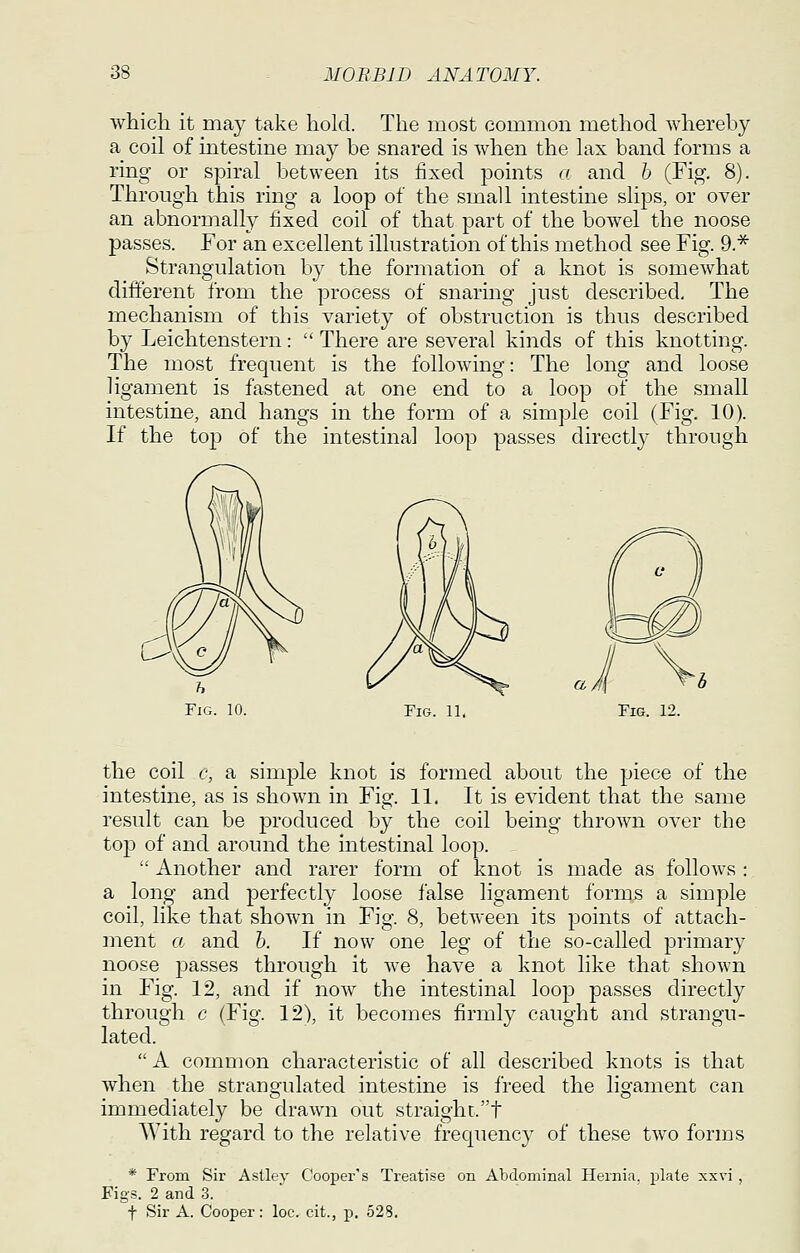 which it may take hold. The most common method whereby a coil of intestine may be snared is when the lax band forms a ring or spiral between its fixed points a and b (Fig. 8). Through this ring a loop of the small intestine slips, or over an abnormally fixed coil of that part of the bowel the noose passes. For an excellent illustration of this method see Fig. 9.* Strangulation by the formation of a knot is somewhat different from the process of snaring just described. The mechanism of this variety of obstruction is thus described by Leichtenstern:  There are several kinds of this knotting. The most frequent is the following: The long and loose ligament is fastened at one end to a loop of the small intestine, and hangs in the form of a simple coil (Fig. 10). If the toj^ of the intestinal loop passes directly through Fig. 11, the coil c, a simple knot is formed about the piece of the intestine, as is shown in Fig. 11. It is evident that the same result can be jDroduced by the coil being thrown over the top of and around the intestinal loop.  Another and rarer form of knot is made as follows : a long and perfectly loose false ligament fornis a simple coil, like that shown in Fig. 8, between its points of attach- ment a and b. If now one leg of the so-called primary noose passes through it we have a knot like that shown in Fig. 12, and if now the intestinal loop passes directly through c (Fig. 12), it becomes firmly caught and strangu- lated.  A common characteristic of all described knots is that when the strangulated intestine is freed the ligament can immediately be drawn out straight.t With regard to the relative frequency of these two forms * From Sir Asllev Cooper's Treatise on Abdominal Hernia, plate xxvi , Figs. 2 and .3.  t Sir A. Cooper: loc. cit., p, 528.