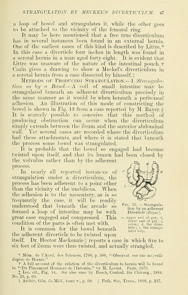 a loop of bowel and strangulates it, while the other goes to be attached to the vicinity of the femoral ring. It may be here mentioned that a free true diverticulum has in several instances been found in an external hernia. One of the earliest cases of this kind is described by Littre.^ In this case a diverticle four inches in length was found in a scrotal hernia in a man aged forty-eight. It is evident that Littre was unaware of the nature of the intestinal pouch, t Cazin gives a drawing to show a Meckel's diverticulum in a scrotal hernia from a case dissected by himself : Methods of Producing Strangulation.—1. Strangula- tion as hy a Band.—A coil of small intestine mav be strangulated beneath an adherent diverticulum precisely in the same manner as it would be when beneath a peritoneal adhesion. An illustration of this mode of constricting the bowel is shown in Fig. 13 from a case reported by M, Eayer. § It is scarcely possible to conceive that this method of producing obstruction can occur when the diverticulum simply extends between the ileum and the anterior abdominal wall. Yet several cases are recorded where the diverticulum had these attachments, and where it is stated that beneath the process some bowel was strangulated. It is probable that the bowel so engaged had become twisted upon itself, and that its lumen had been closed by the volvulus rather than by the adherent _^ r, process. J^l^ ■ Cl In nearly all reported instances of ^ ^ 1'^%'wr^t§ strangulation under a diverticulum, the t \3\i-i J process has been adherent to a point other ^i/5^^r than the vicinity of the umbilicus. When ' ./^r^^ the adhesion is to the inesenter}', as is so ''^^^■''^ frequently the case, it will be readity ^^^--^ understood that beneath the arcade so ^^°;- ^'\~ Stranguia- p , , „ . . , . , tiou by an adherent lormed a loop ot mtestme may be Avith Diverticie (Zr-ff^/e/). great ease engaged and compressed. This «, pp'-r end of gut; 6, condition of the parts is often met with. coTon;*^d, the°diver' It is common for the bowel beneath Jatea'ioop'^^ strangu- the adherent diverticle to be twisted upon itself Dr. Hector Mackenzie || reports a case in which five to six feet of ileum were thus twisted, and actuall}^ strangled. * Jlem. de I'Aead, des Sciences, 1700, p. 300, Observat. sur ime nouvellc £spece de Hernie. t A full account of the relation of the diverticulum to hernia will he found in Du Pincement Herniare de I'lntestin, hy M. Loviot. Pari?, 1879. X Loc. cit., Fig. 14. Sec also case by Busch, Central, fiir Chirurg., 1884, Xo. 23, p. 69. § Archiv. Gen. de Med., tome v., p. 68. |i Path. Soc. Trans., 1890, p. 127.