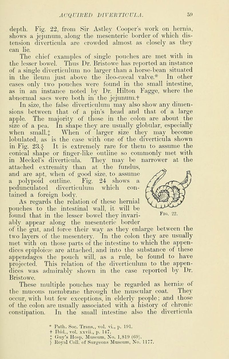 depth. Fig. 22, from Sir Astley Cooper's work on hernia, shows a jejunum, along the mesenteric border of which dis- tension diverticula are croAvded almost as closely as they can he. The chief examples of single pouches are met with in the lesser bowel. Thus Dr. Bristowe has reported an instance of a single diverticulum no larger than a horse-bean situated in the ileum just above the ileo-csecal valve.^ In other cases only two pouches were found in the small intestine, as in an instance noted by Dr. Hilton Fagge, where the abnormal sacs were both in the jejunum.f In size, the false diverticulum may also show any dimen- sions between that of a pin's head and that of a large apple. The majority of those in the colon are about the size of a pea. In shape they are usually globular, especiall}^ when small.J When of larger size they may become lobulated, as is the case with one of the diverticula shown in Fig. 23. § It is extremely rare for them to assume the conical shape or finger-like outline so commonly met with in Meckel's diverticula. They may be narrower at the attached extremity than at the fundus, and are apt, when of good size, to assume a polypoid outline. Fig. 24 shoAvs a pedunculated diverticulum which con- tained a foreign body. As regards the relation of these hernial pouches to the intestinal wall, it will be found that in the lesser bowel they invari- -^^^^ -^■ ably appear along the mesenteric border of the gut, and force their way as they enlarge between the two layers of the mesentery. In the colon they are usually met with on those parts oi' the intestine to which the appen- dices epiploica3 are attached, and into the substance of these appendages the pouch will, as a rule, be found to have projected. This relation of the diverticulum to the appen- dices was admirably shown in the case reported by Dr. Bristowe. These multiple pouches may be regarded as hernia of the mucous membrane through the muscular coat. They occur, with but few exceptions, in elderty people; and those of the colon are usually associated with a history of chronic constipation. In the small intestine also the diverticula * Path. Soc. Trans., vol. vi., p. 191. t Ibid., vol. xxvii., p. 147. : Guj^'s Hosp. Museum, No. 1,819 (69). \ Eo)-al Coll. of Surg-eons Museum, No. 1177.